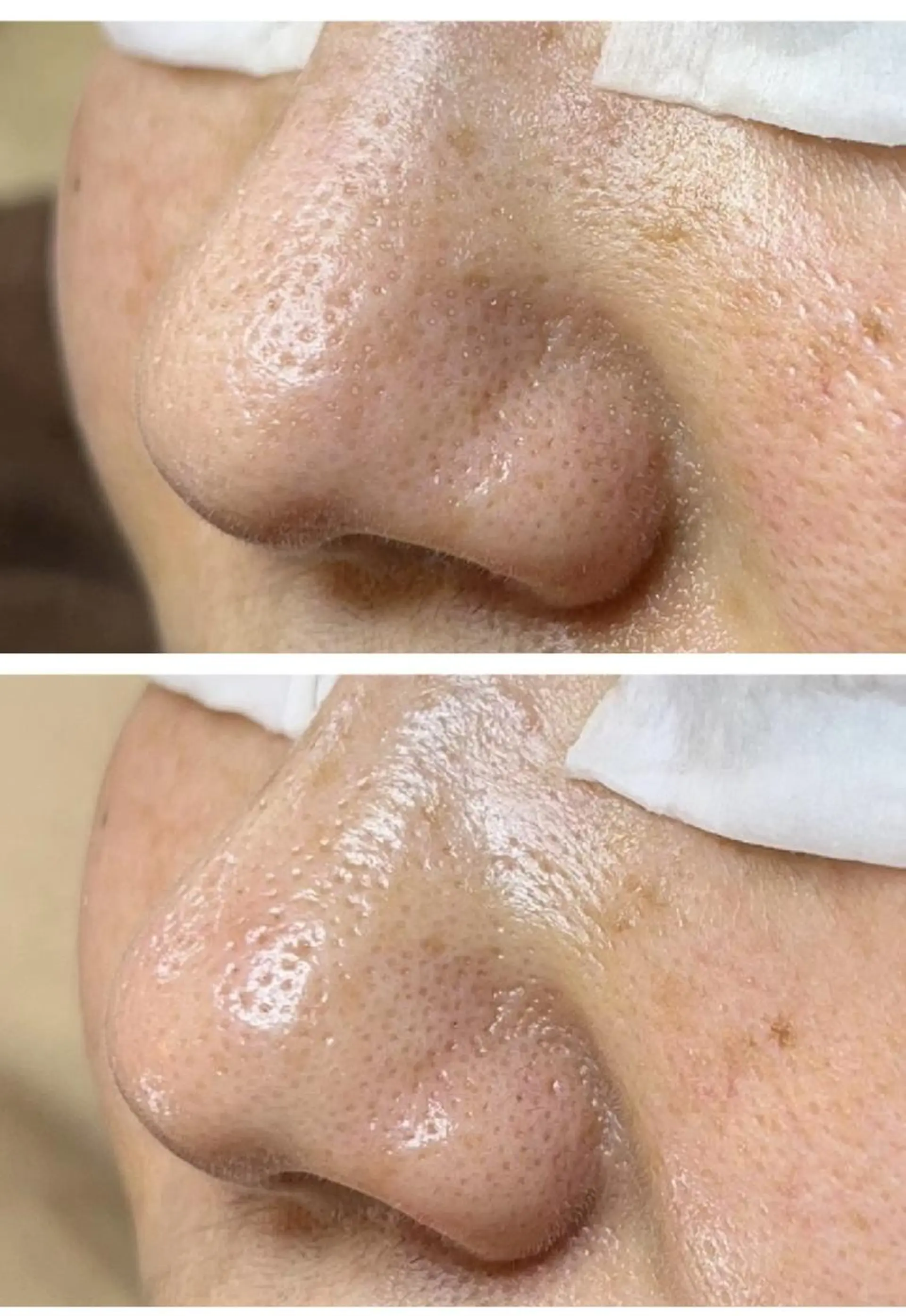 エステ Lipula リプラ所属・毛穴ツヤ肌専門    Lipulaのエステ・リラクイメージ