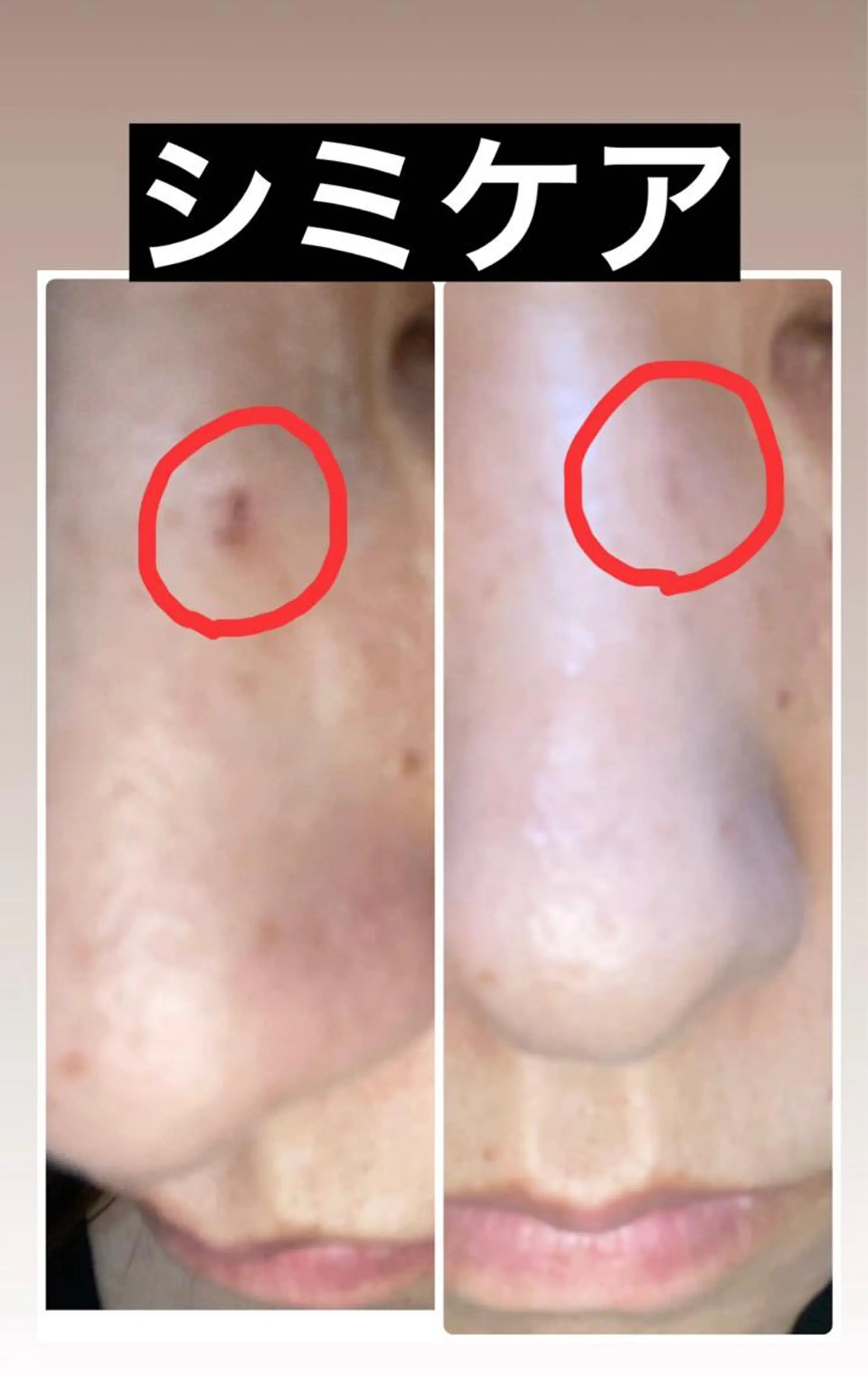 ANGEL NAIL所属・RE:BORN 大阪四條畷市のエステ・リラクイメージ