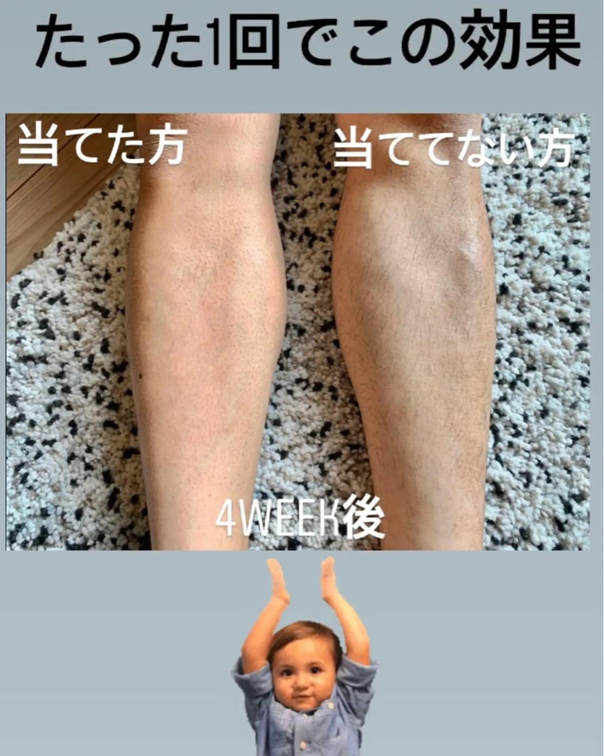 メンズ 脱毛＆エステサロン【アンリミット】所属・森谷 莉美のエステ・リラクイメージ