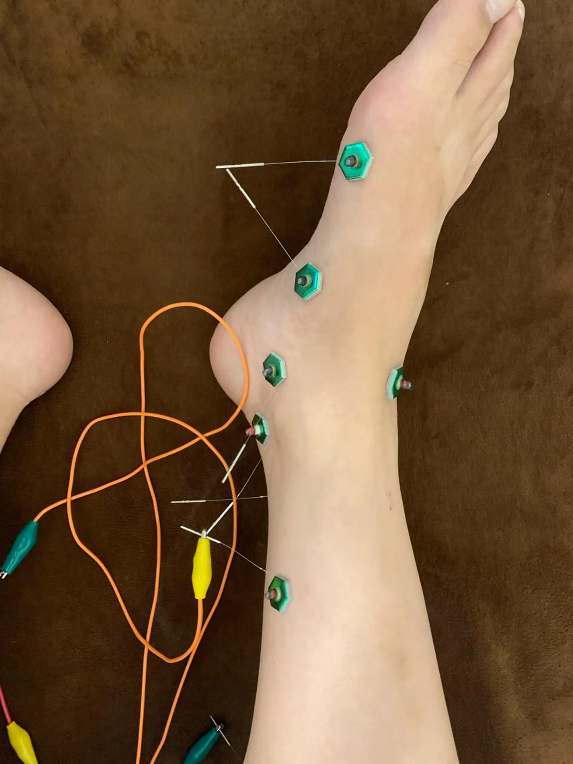 表参道鍼灸院K 美容鍼🔮ララピールのエステ・リラクイメージ