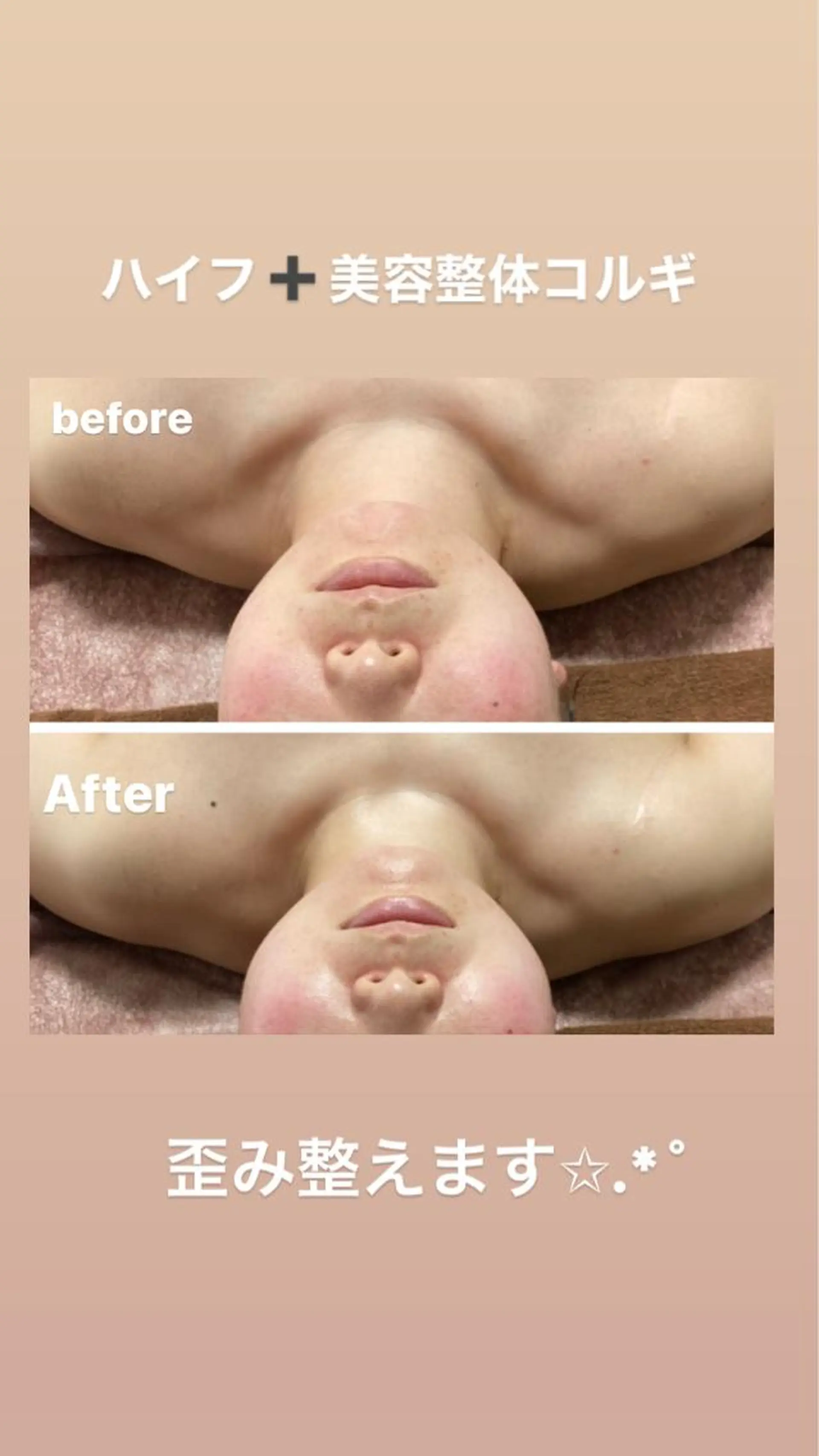 その他 美顔秘密基地新宮所属・美顔秘密基地 新宮のその他イメージ