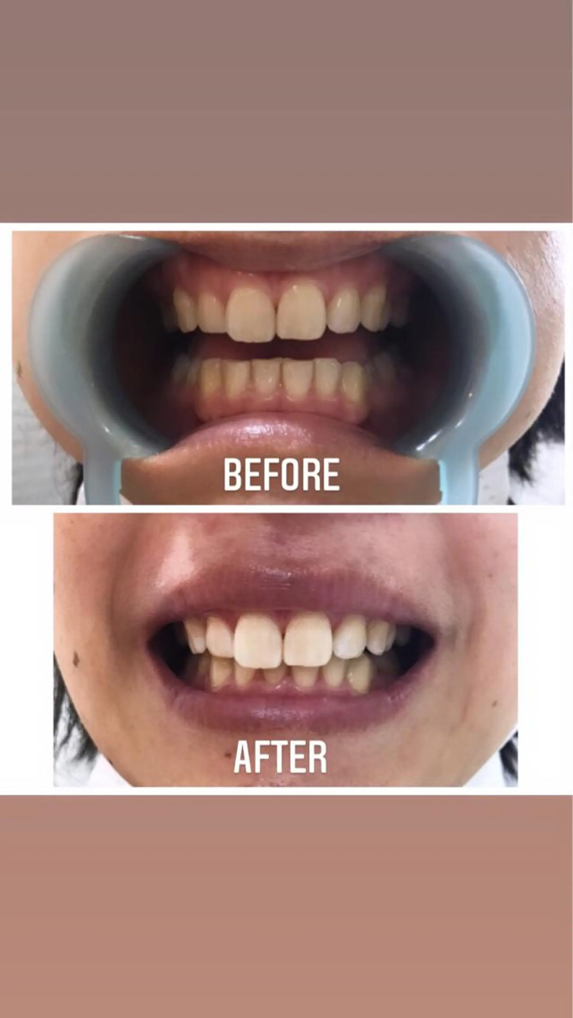 M渋谷店所属・Ｍ渋谷 ホワイトニングのエステ・リラクイメージ