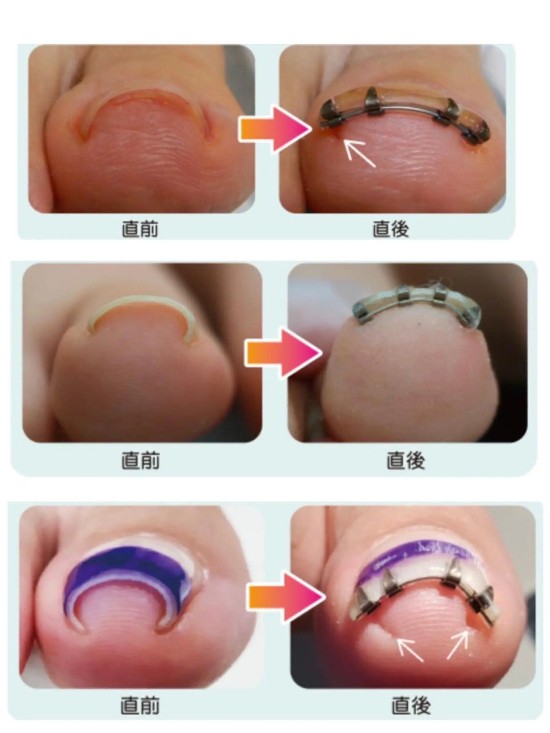 ネイル CROWN プライベートサロンのネイルデザイン