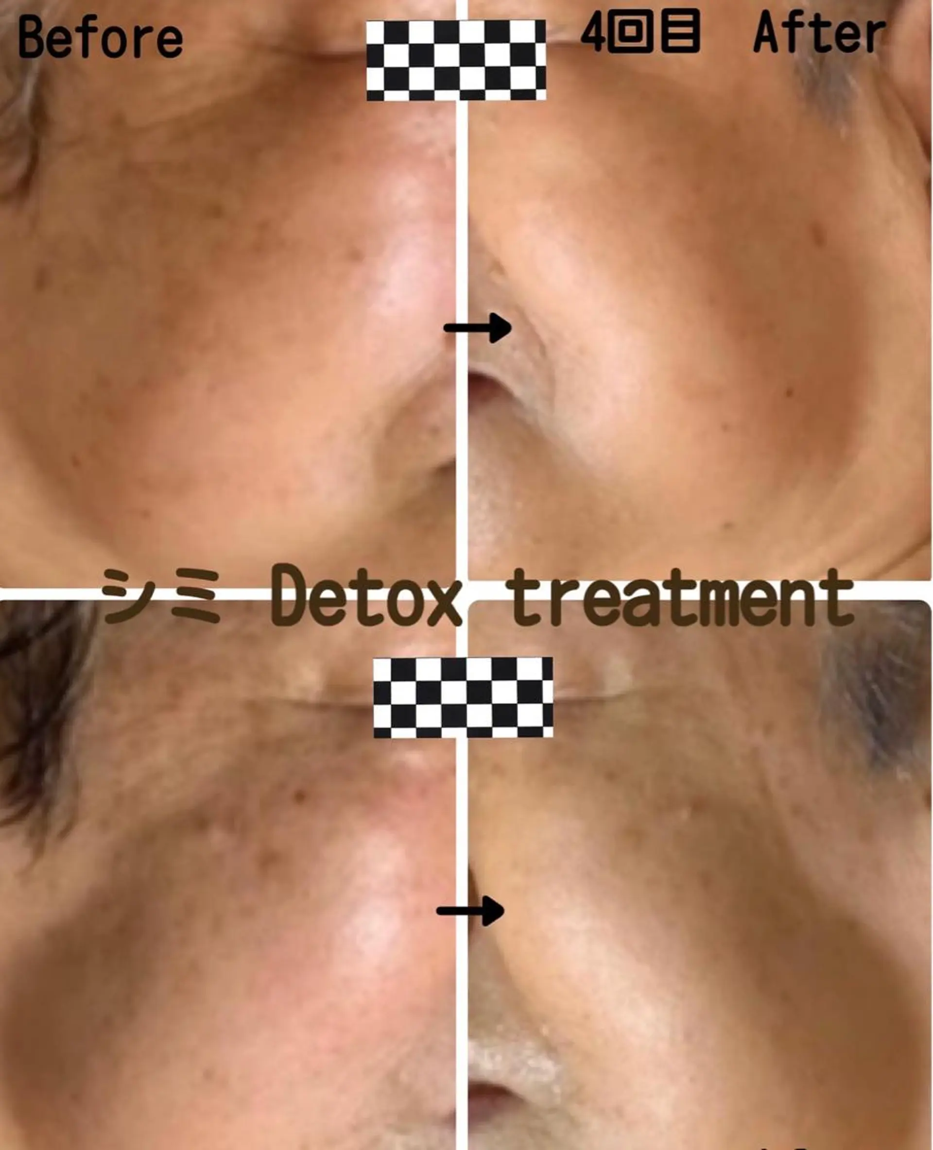 エステ ヴィーナス ビューティーのエステ・リラクイメージ