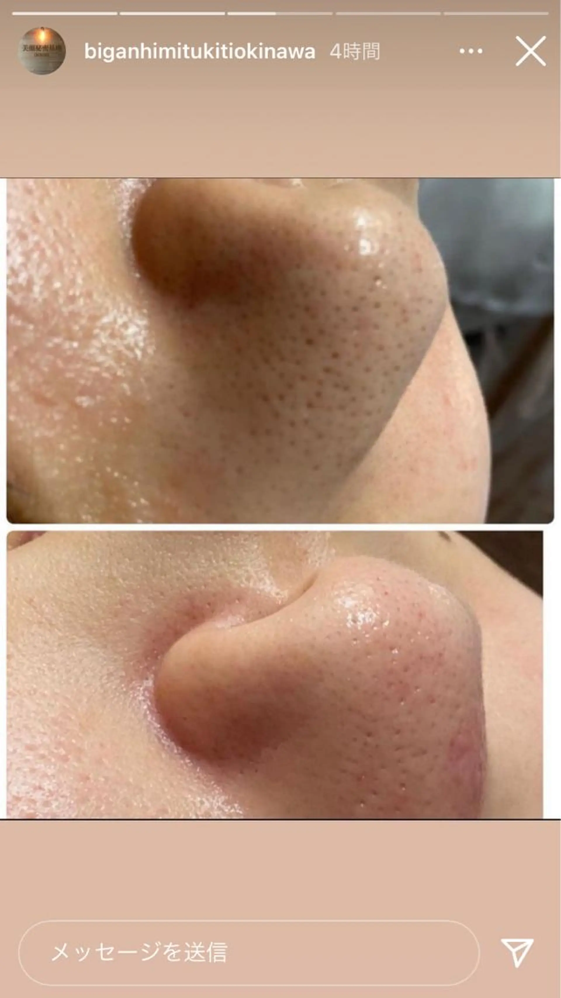 エステ 美顔秘密基地新宮所属・美顔秘密基地 新宮のその他イメージ