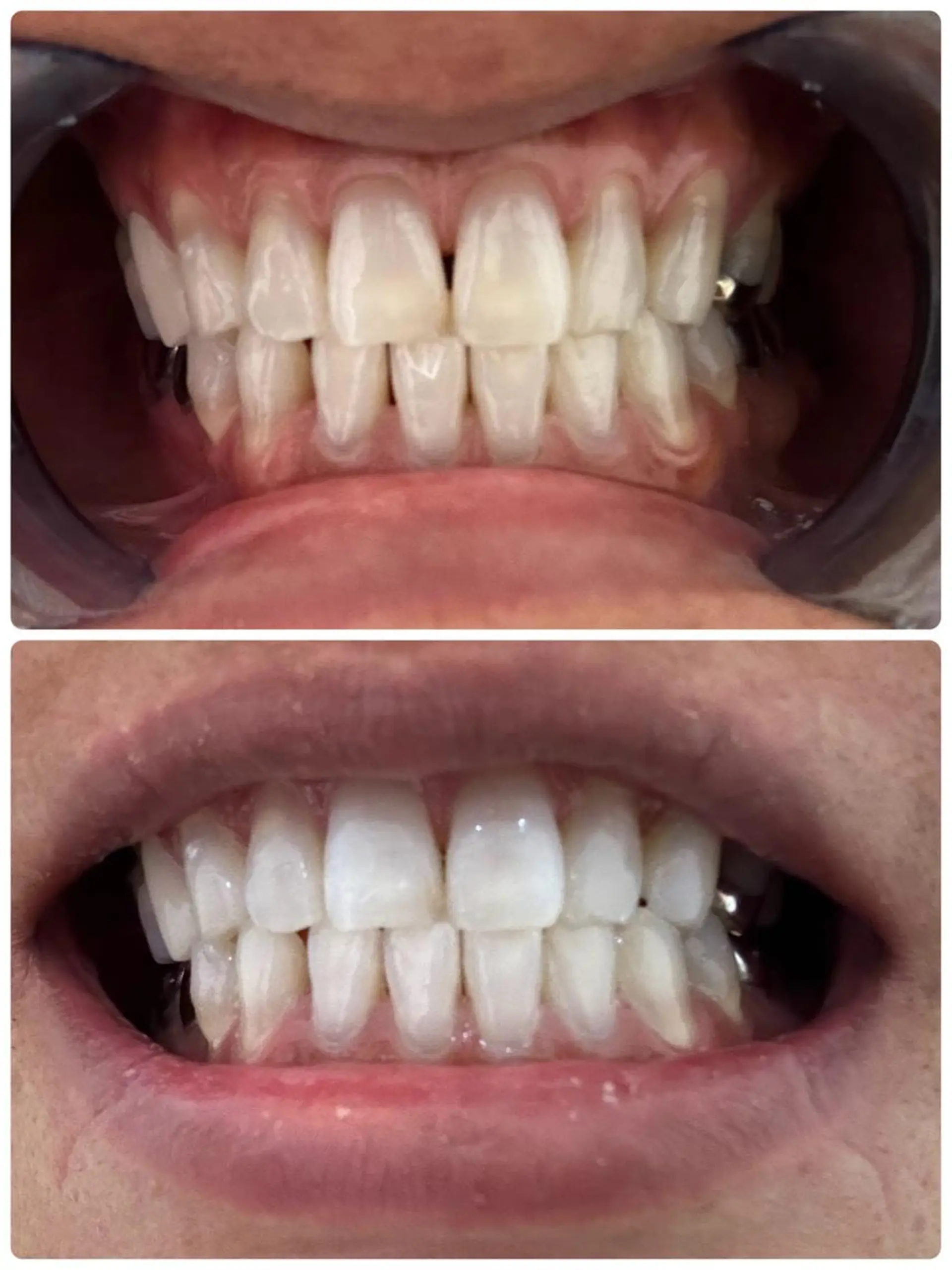 その他 ホワイトニングジム 池袋のその他イメージ