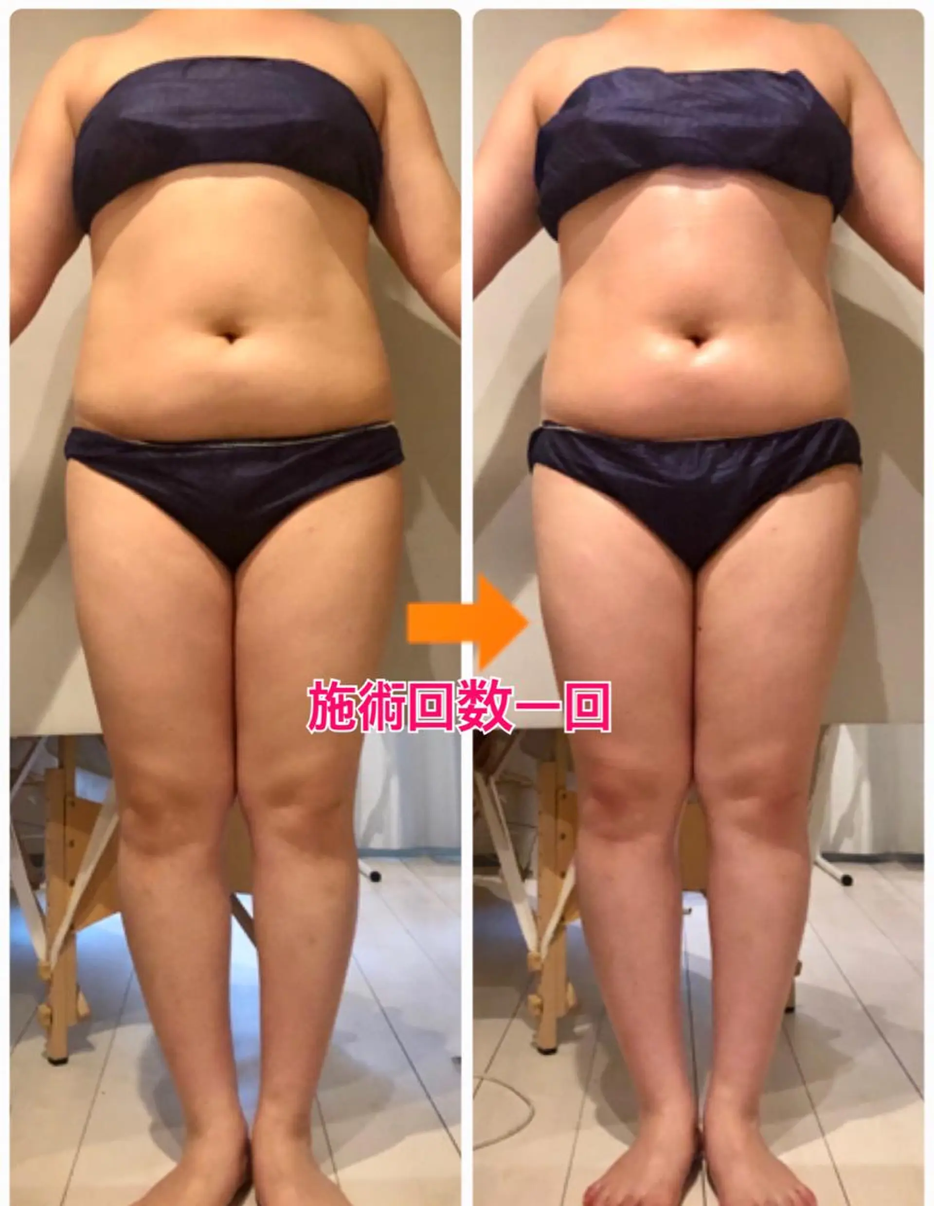 ミディアム カラー パーマ ヘアアレンジ メンズ キッズ ネイル マツエク・マツパ ‍痩身＆ボディ 結果出し🌟丹野のエステ・リラクイメージ