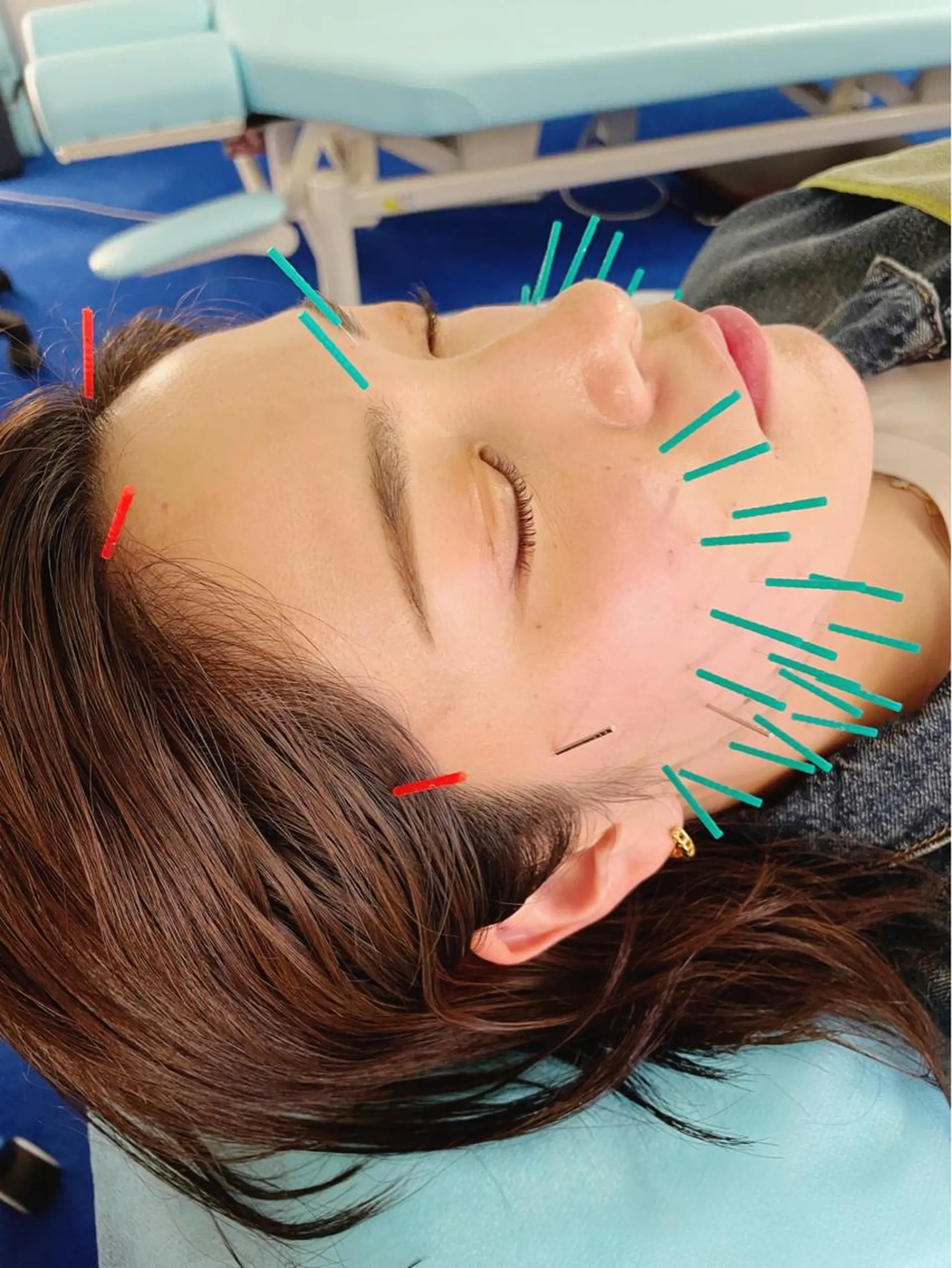 エステ リラク 小顔美容鍼専門サロン 渋谷YZのその他イメージ