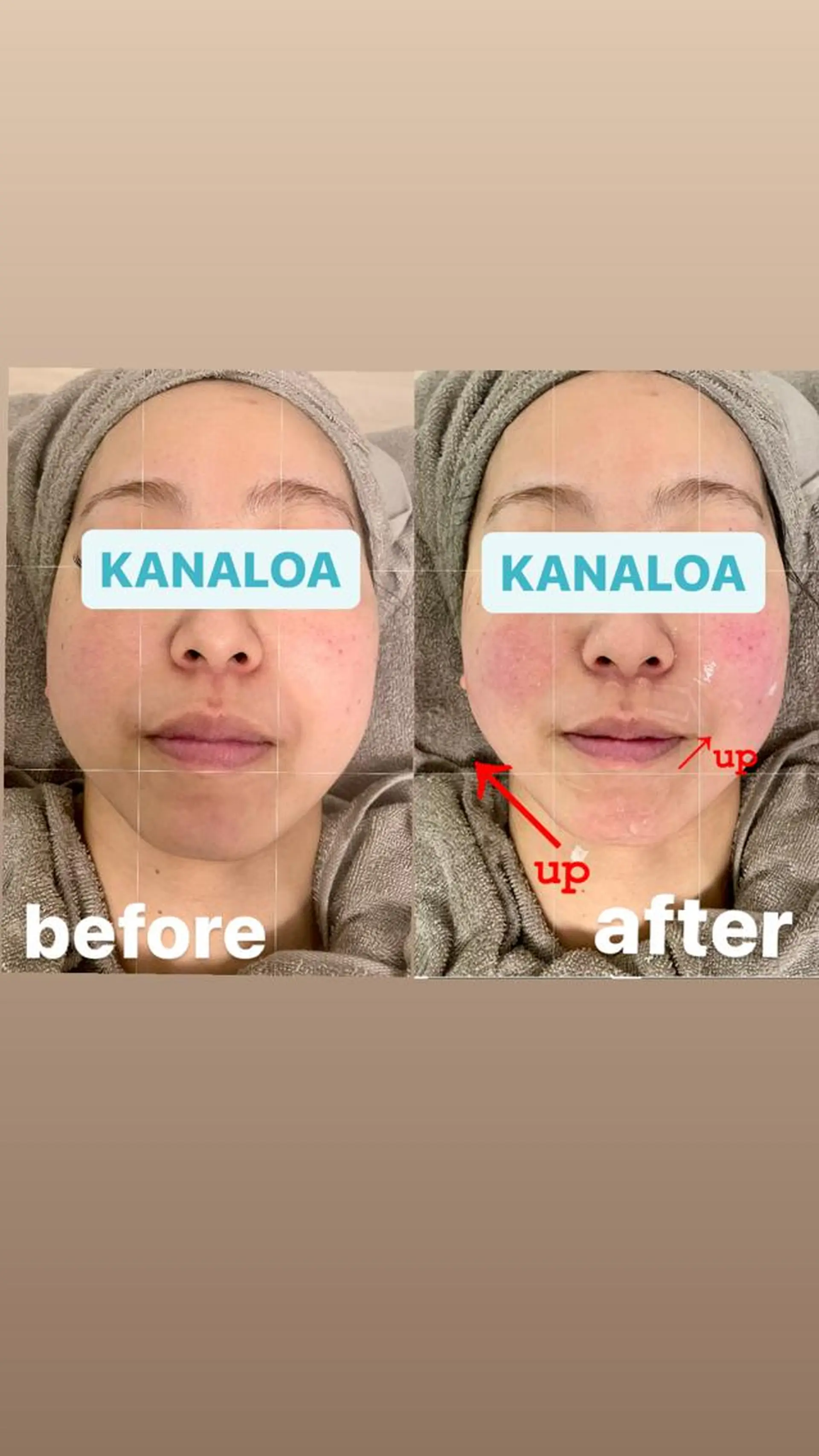 Kanaloa beauty salon所属・腸もみ・メンズ脱毛・ 毛穴洗浄〜カナロア〜のエステ・リラクイメージ