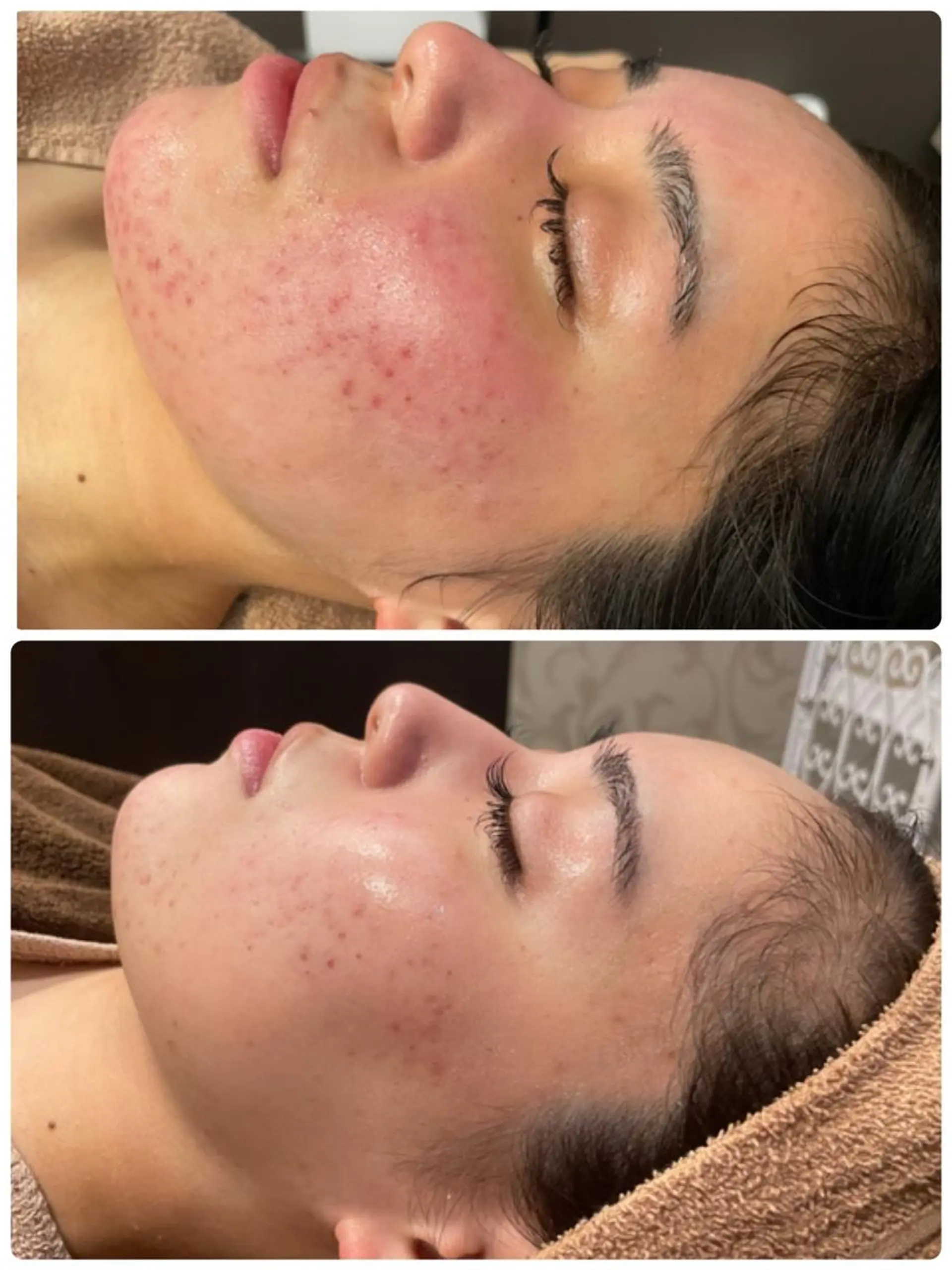 RAYVIS梅田店 FUJIのエステ・リラクイメージ