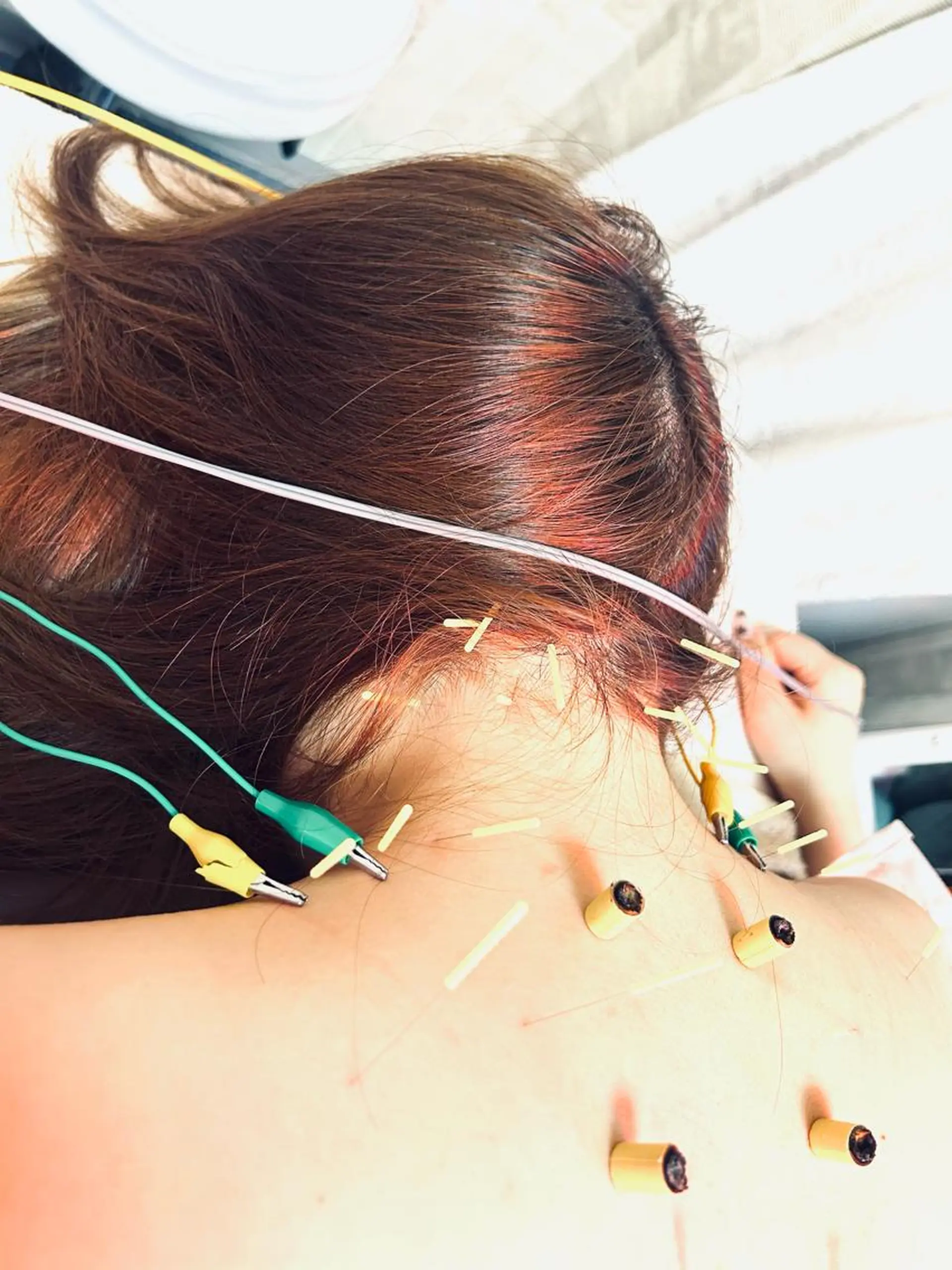 その他 美容鍼灸サロン mahoroba院長のエステ・リラクイメージ