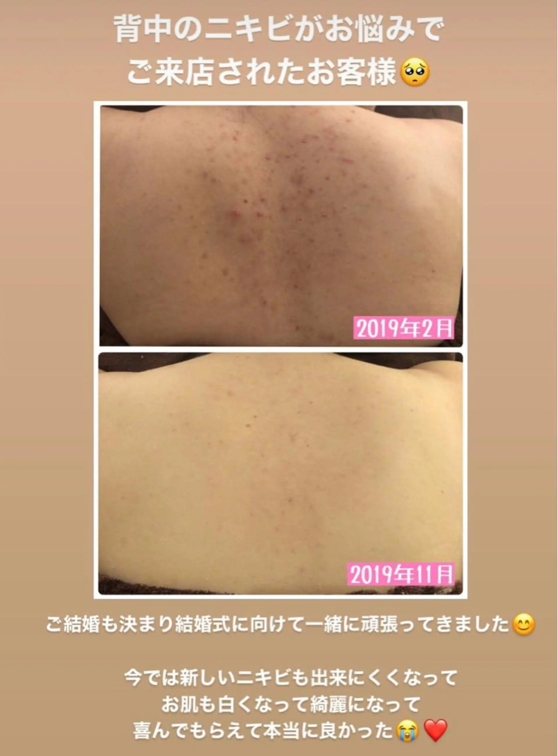 ミディアム カラー パーマ ヘアアレンジ メンズ キッズ ネイル マツエク・マツパ エステ リラク ニキビ・肌質改善専門 ♡人生が変わるサロンのエステ・リラクイメージ