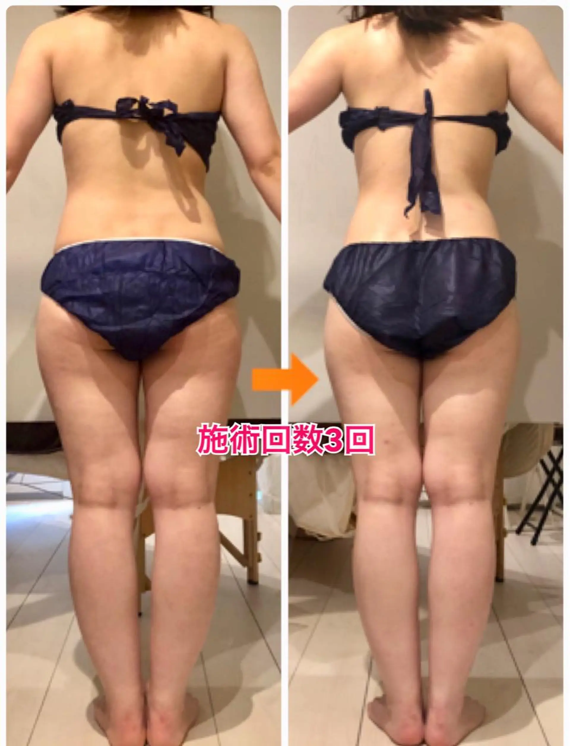 ロング カラー パーマ ヘアアレンジ メンズ キッズ ネイル マツエク・マツパ ‍痩身＆ボディ 結果出し🌟丹野のエステ・リラクイメージ