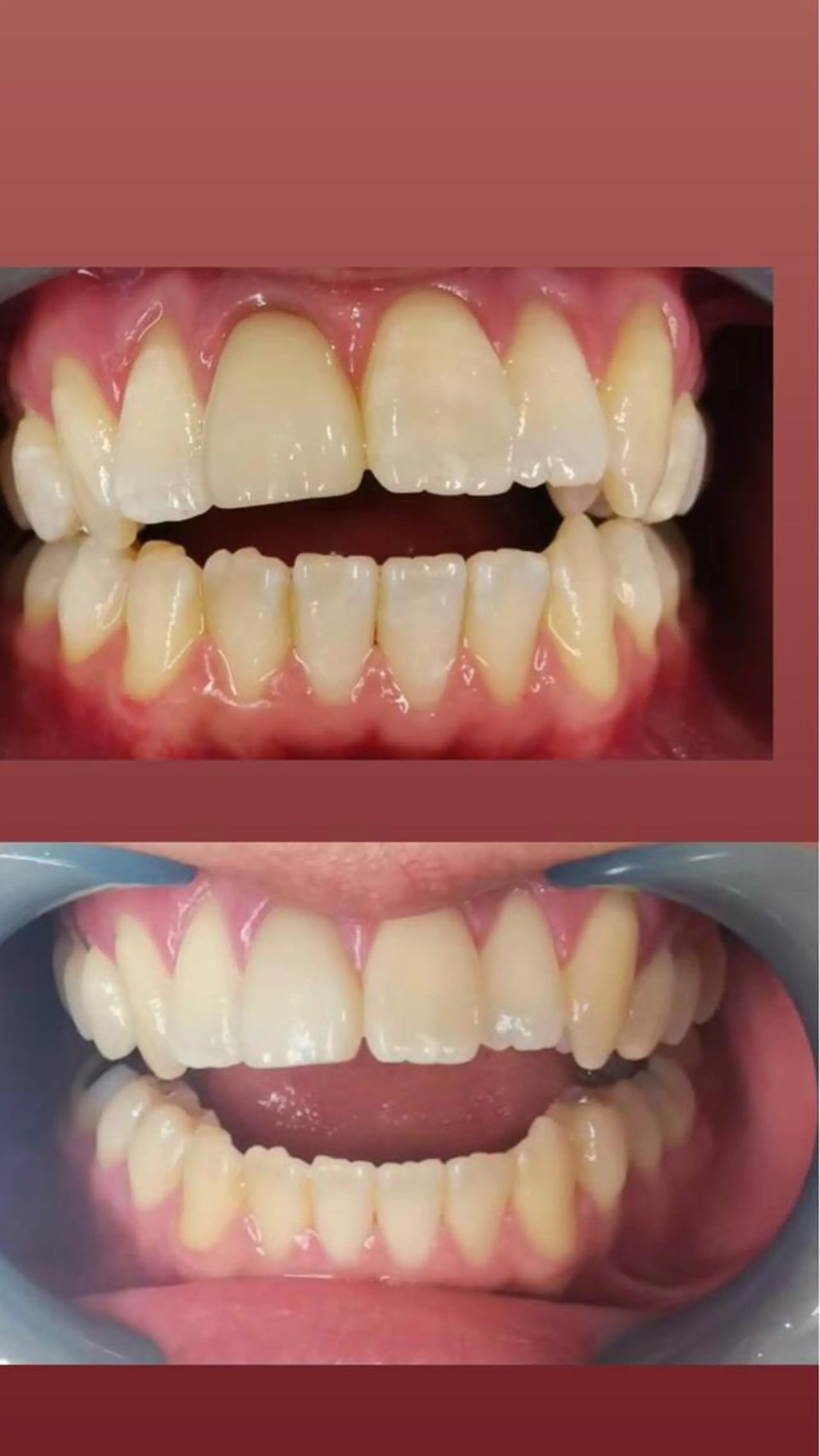 LAVISH nail salonのネイルデザイン