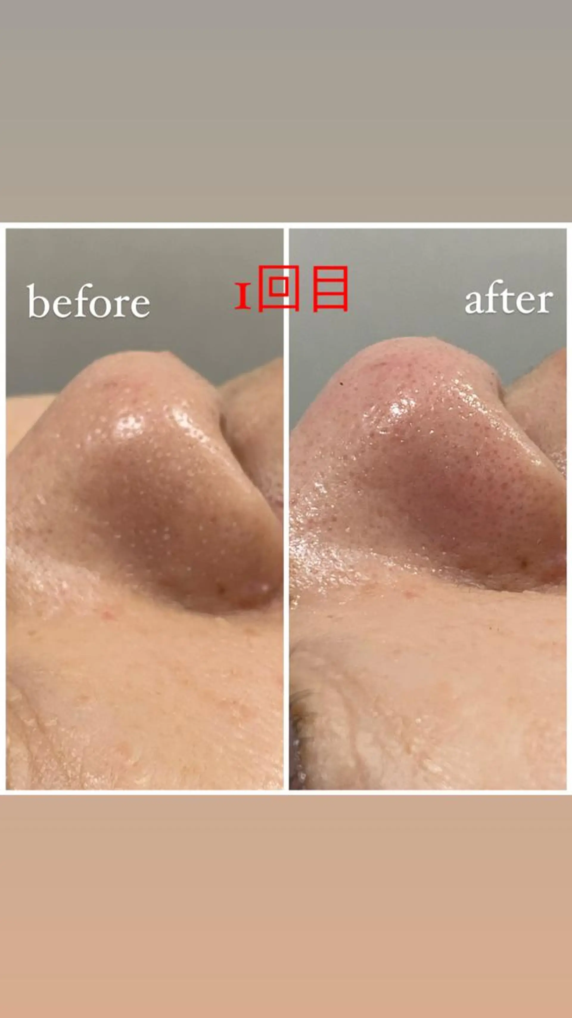 アルカンジュ~archange~所属・痩身/毛穴洗浄/脱毛 アルカンジュのエステ・リラクイメージ