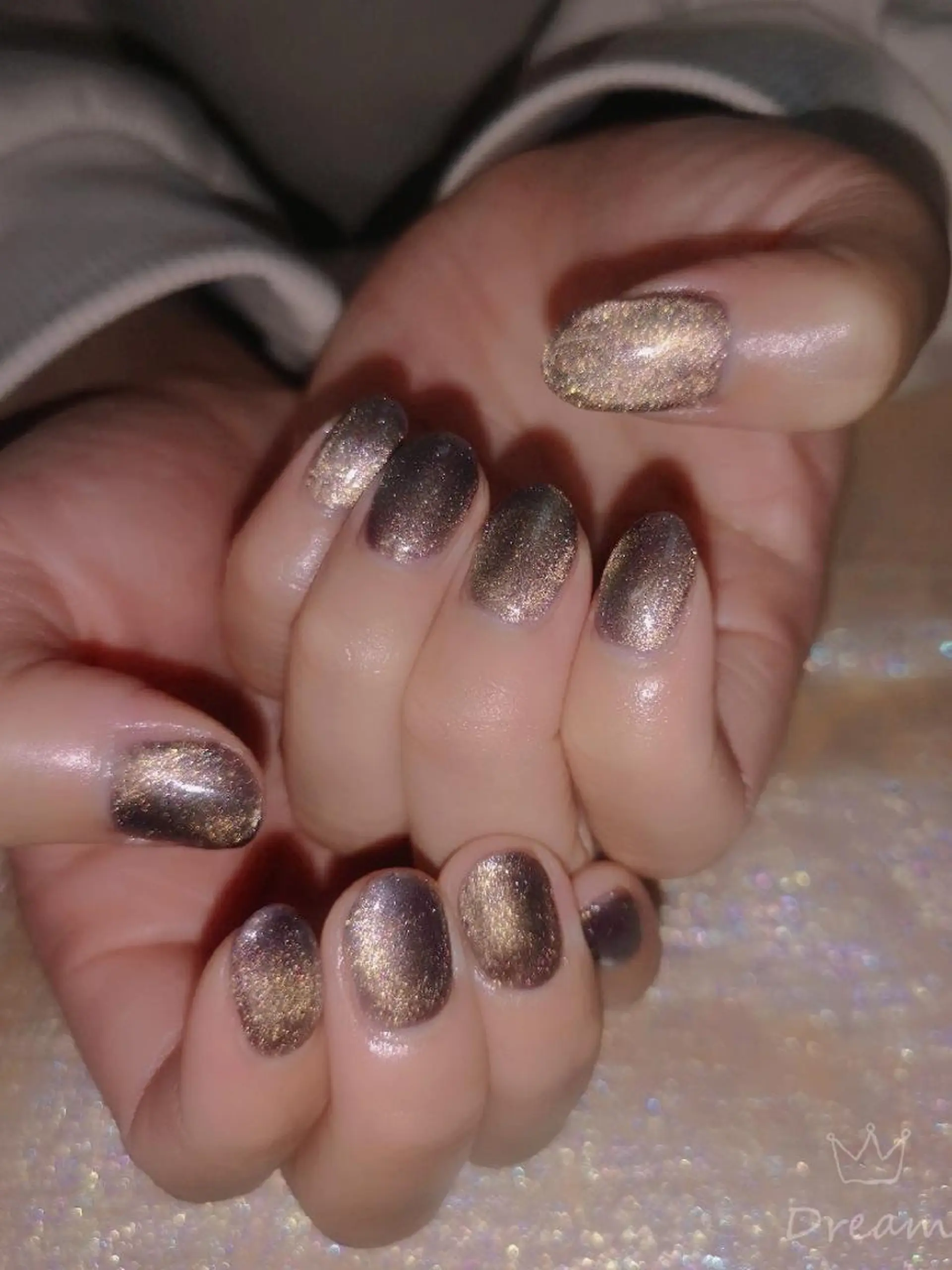 ネイル ハンドネイル ネイリストゆか💅 長さだし、深爪矯正のネイルデザイン