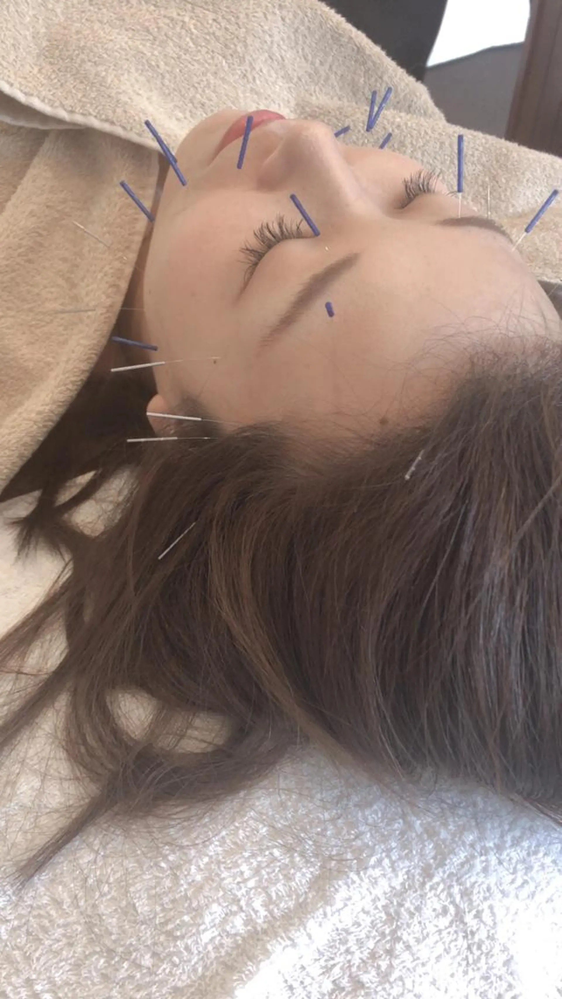 美容鍼・鍼灸専門❤✨ 近藤めぐみのエステ・リラクイメージ