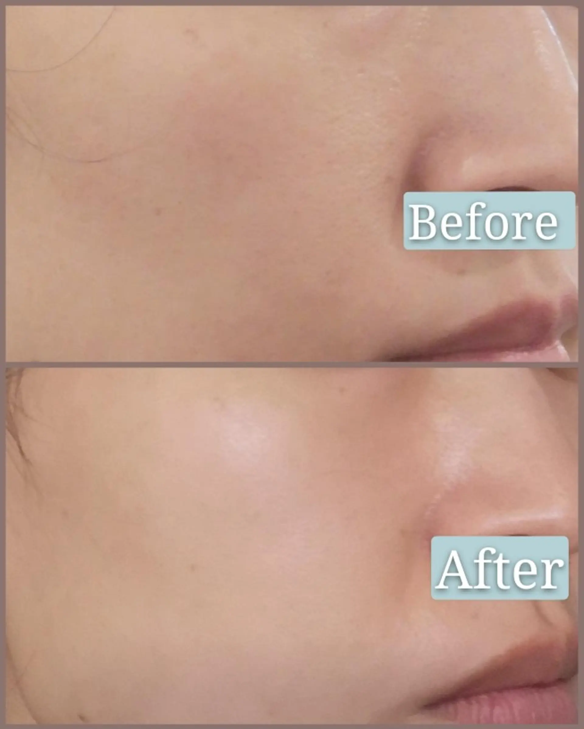 🅖🅤🅩🅔🅛 salonのエステ・リラクイメージ