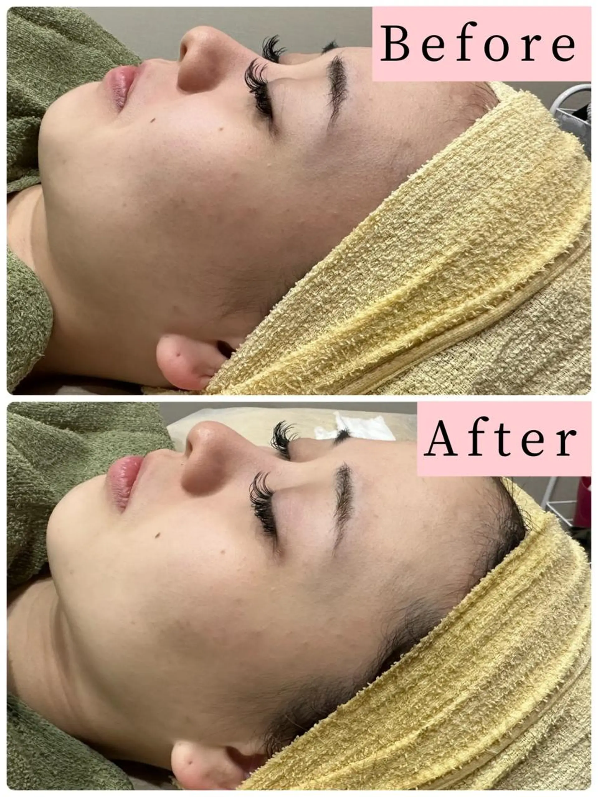 ハーブピーリング専門 muro.のエステ・リラクイメージ