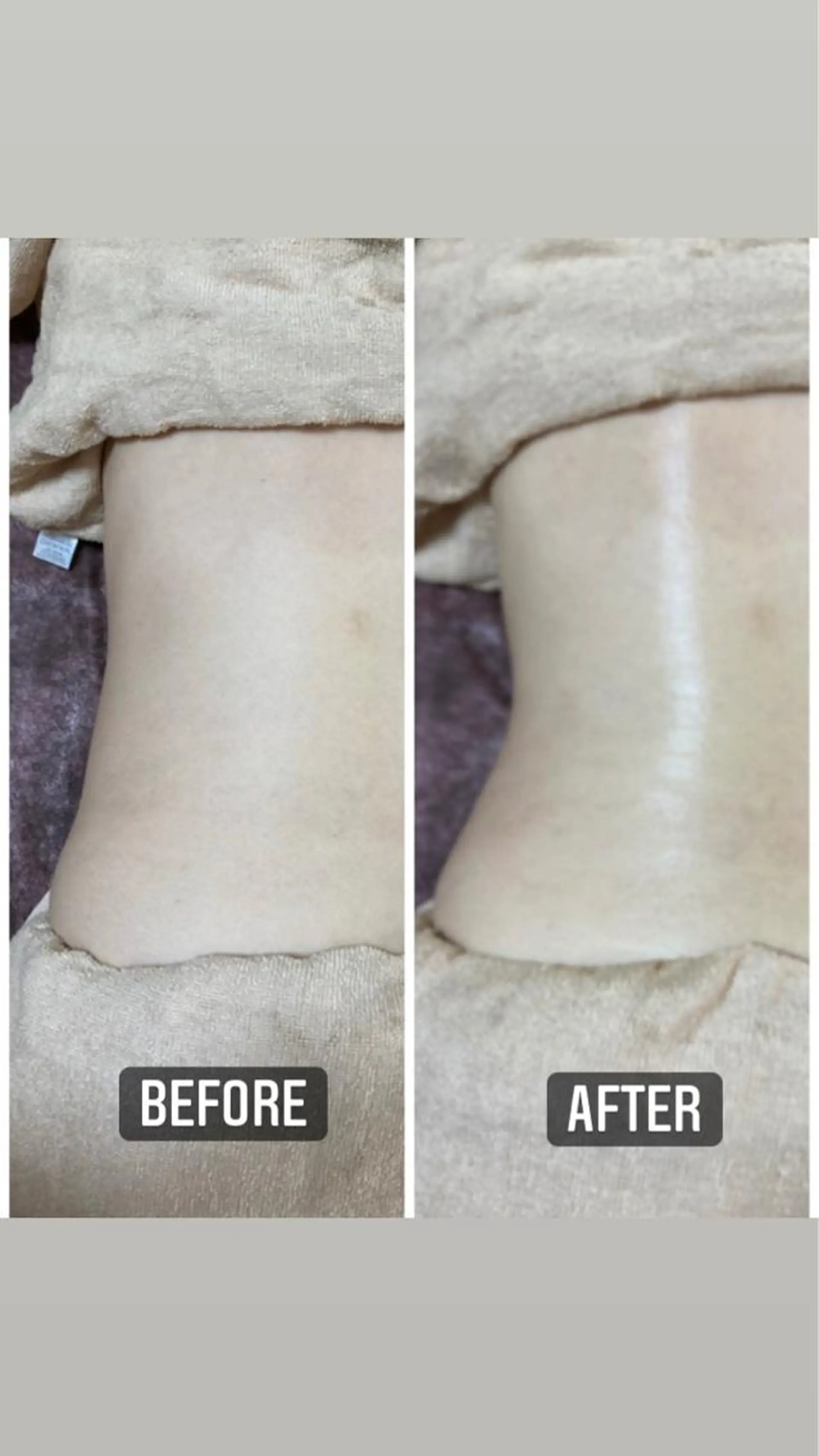 その他 美顔秘密基地新宮所属・美顔秘密基地 新宮のその他イメージ