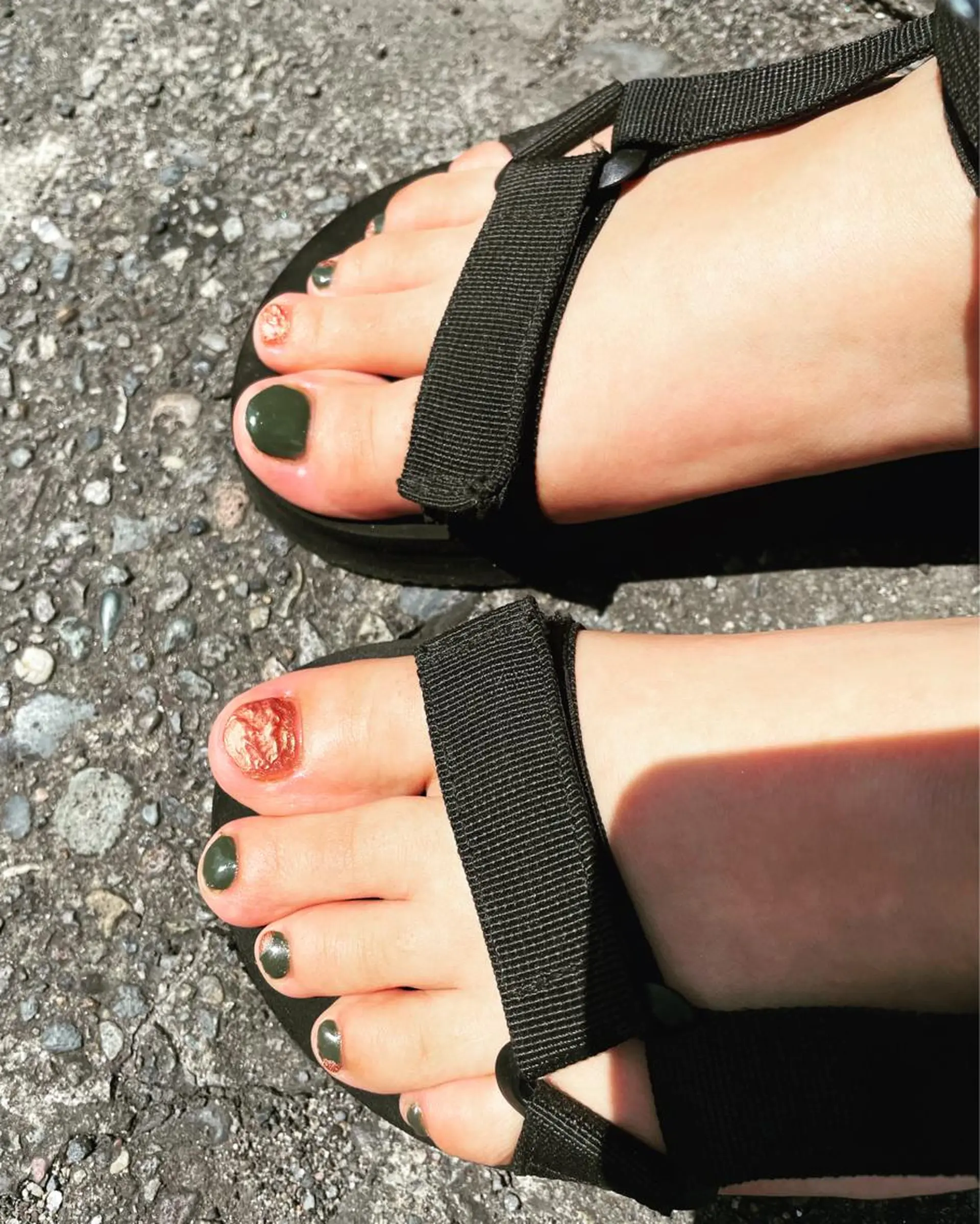 ネイル フットネイル CRAZY NAILのネイルデザイン