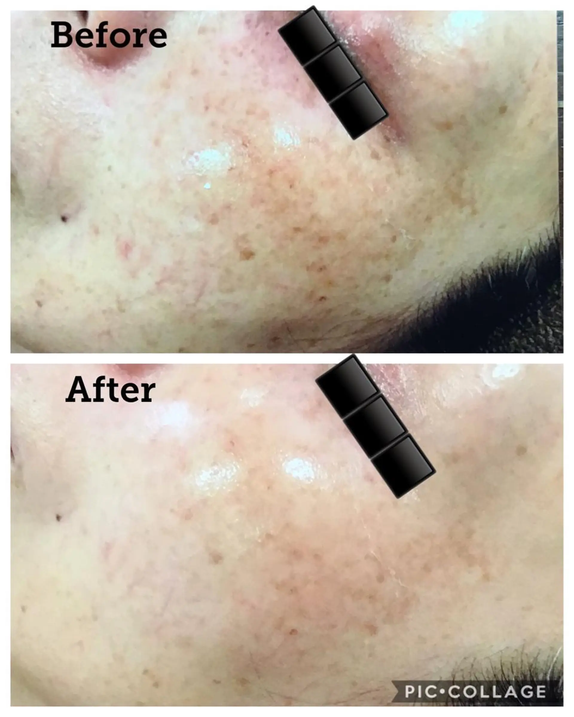 ジョリ   ヴェール 山口のマツエク・マツパデザイン