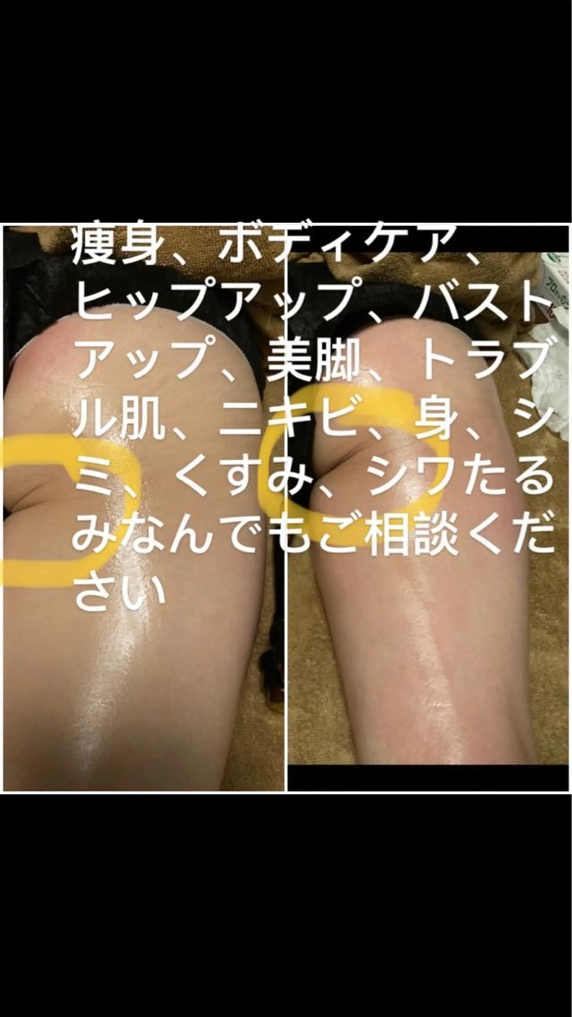 トータルビューティ美麗所属・トータルビューティ 美麗のエステ・リラクイメージ