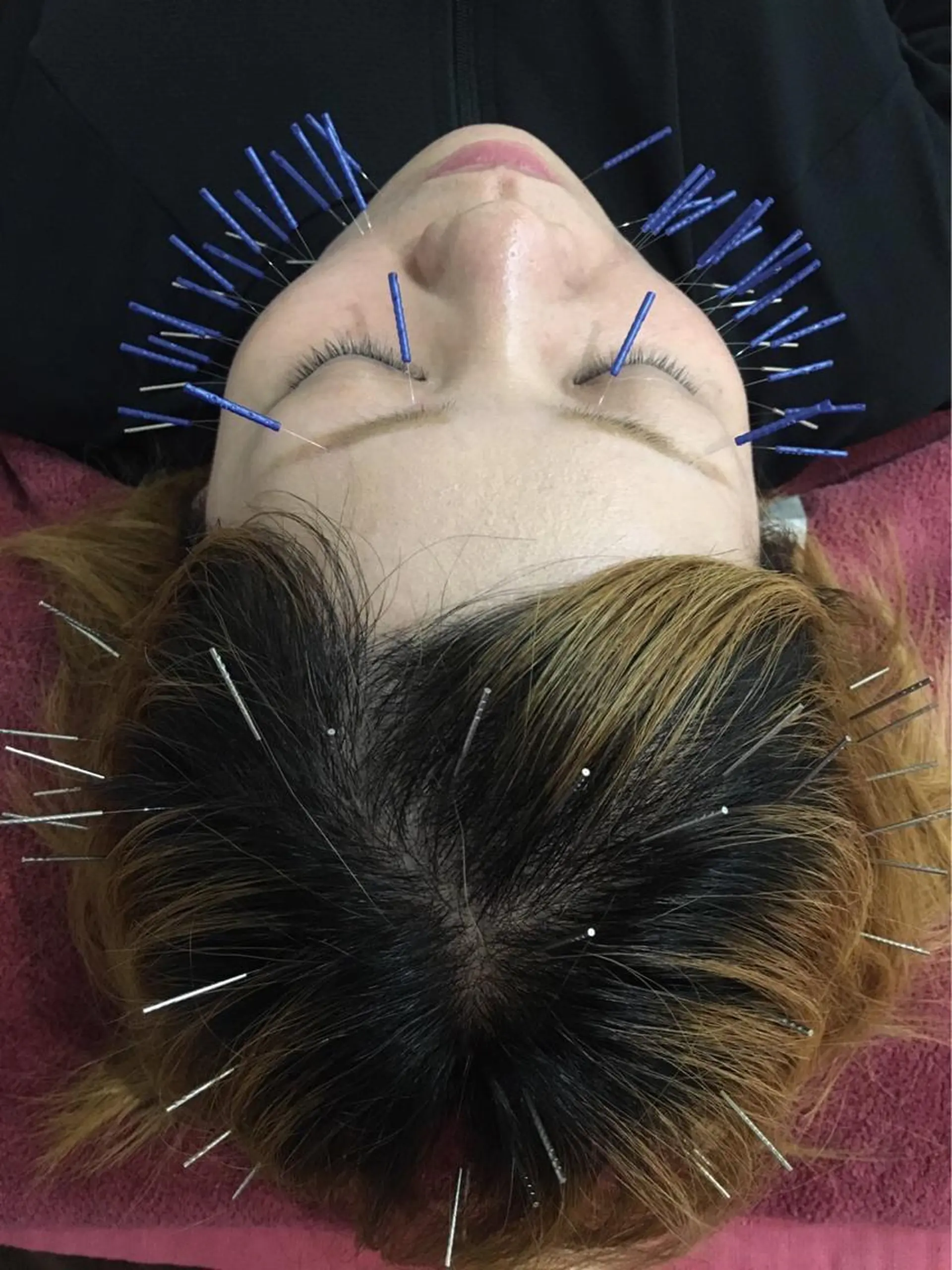 エステ リラク 美容鍼灸女性専用 りんご鍼灸治療院のその他イメージ