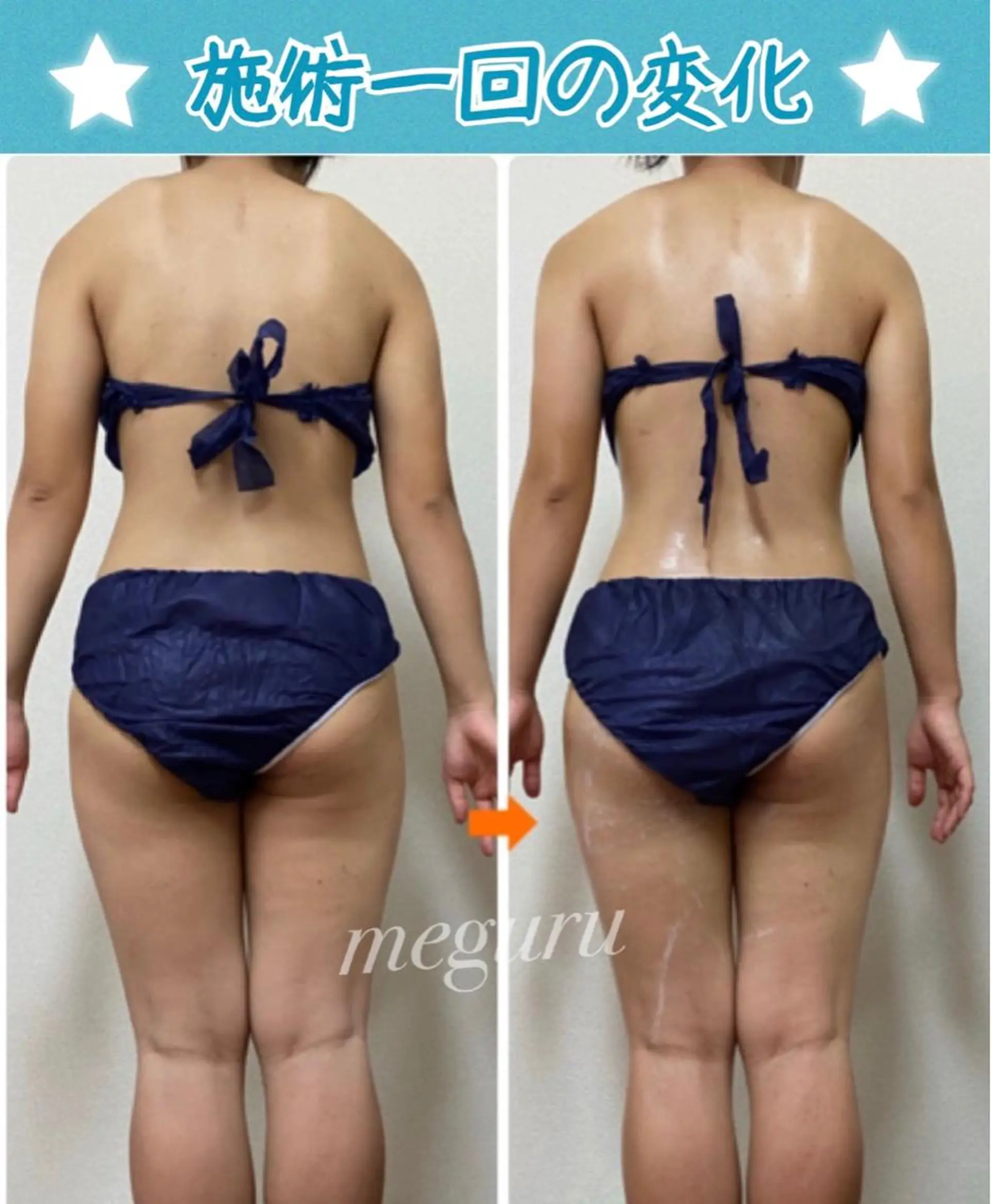 ショート カラー パーマ ヘアアレンジ メンズ キッズ ネイル マツエク・マツパ エステ リラク ‍痩身＆ボディ 結果出し🌟丹野のエステ・リラクイメージ