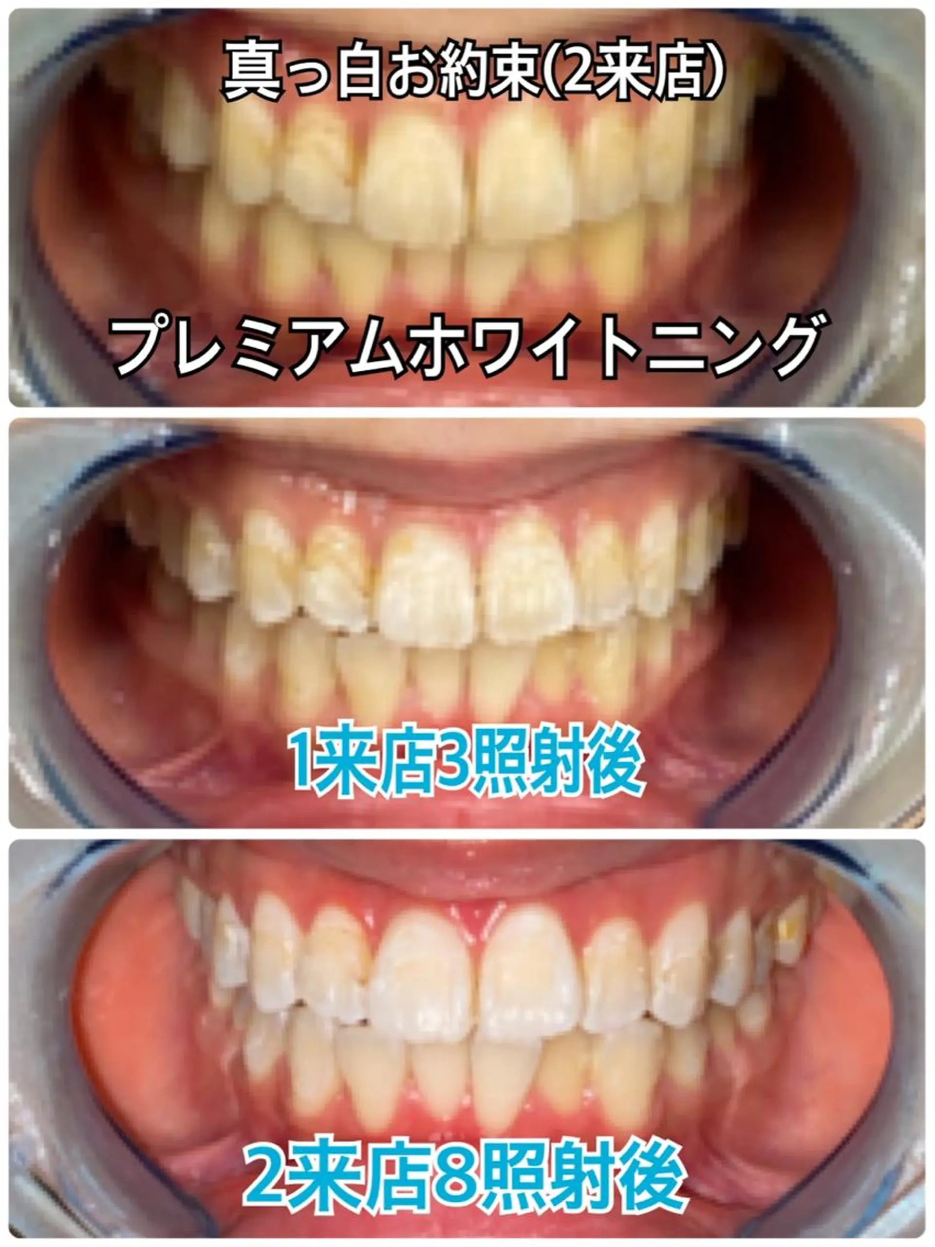 Platinum Beauty 四条烏丸店所属・吉田亮利 ホワイトニング専門店のその他イメージ