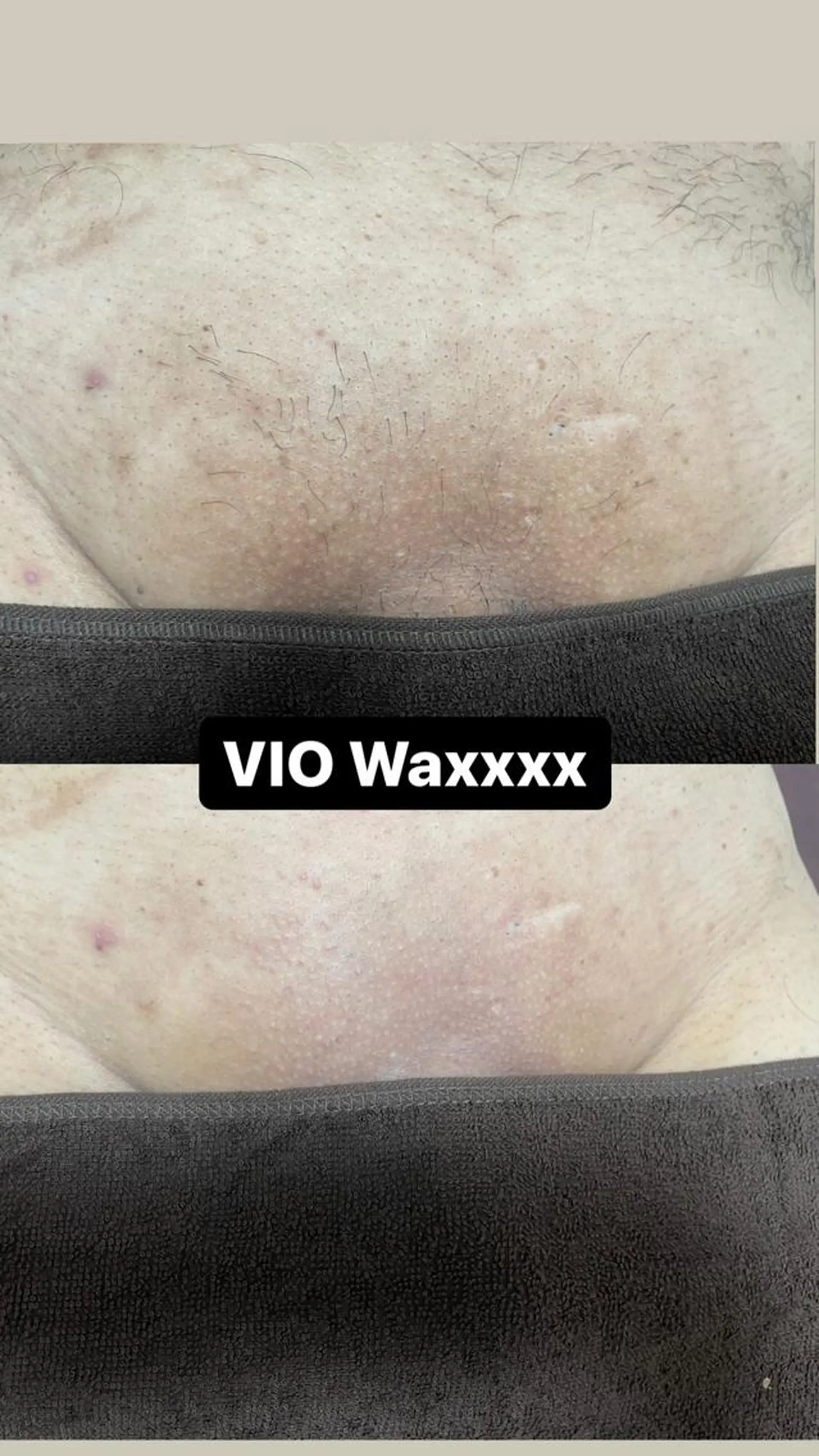 メンズ 脱毛 Epina 千葉店 【エピナ】のエステ・リラクイメージ