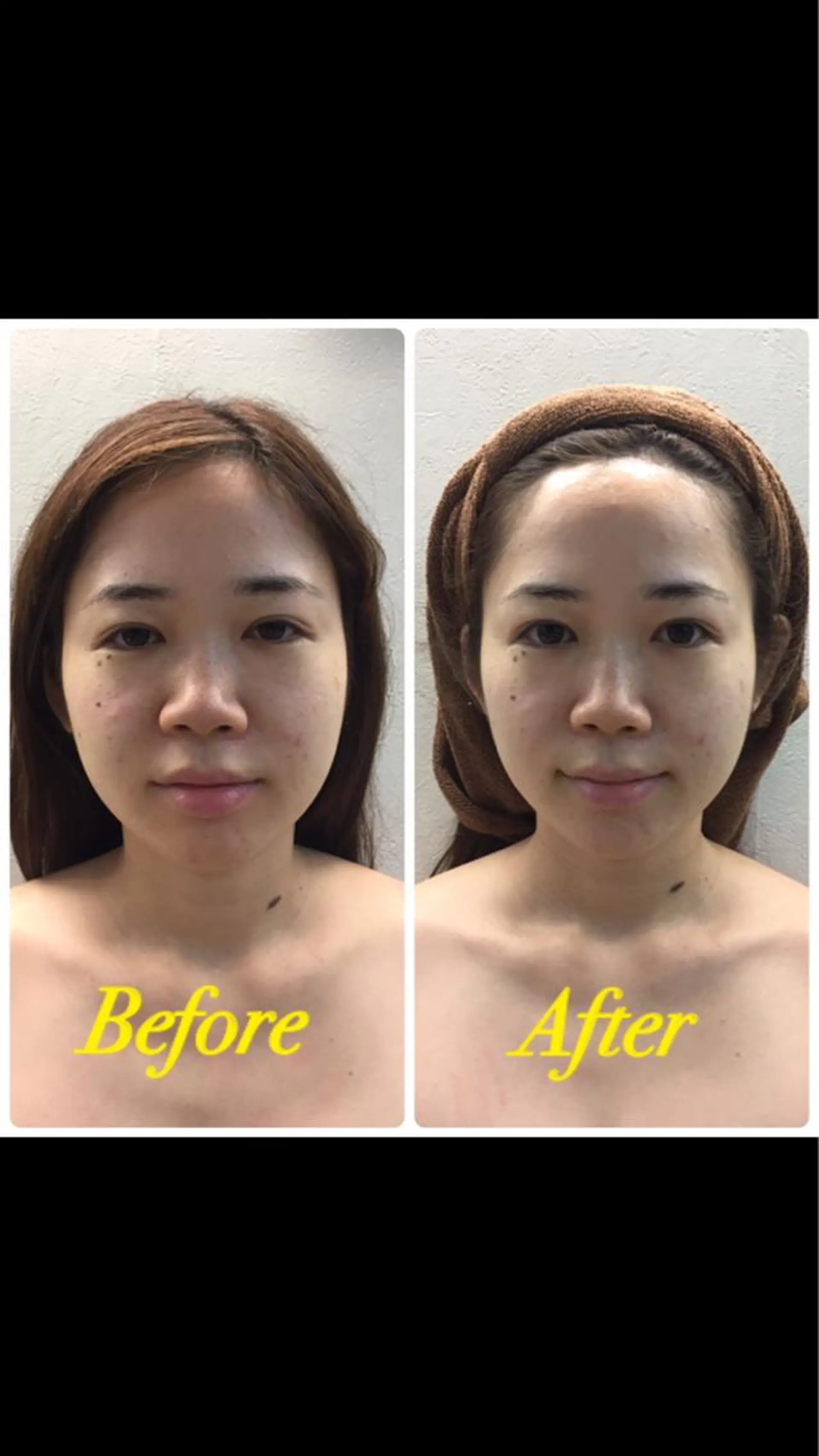 エステ DeCoLé Beauty所属・艶肌/敏感肌/若さ/ ボディ痩身🌿のエステ・リラクイメージ