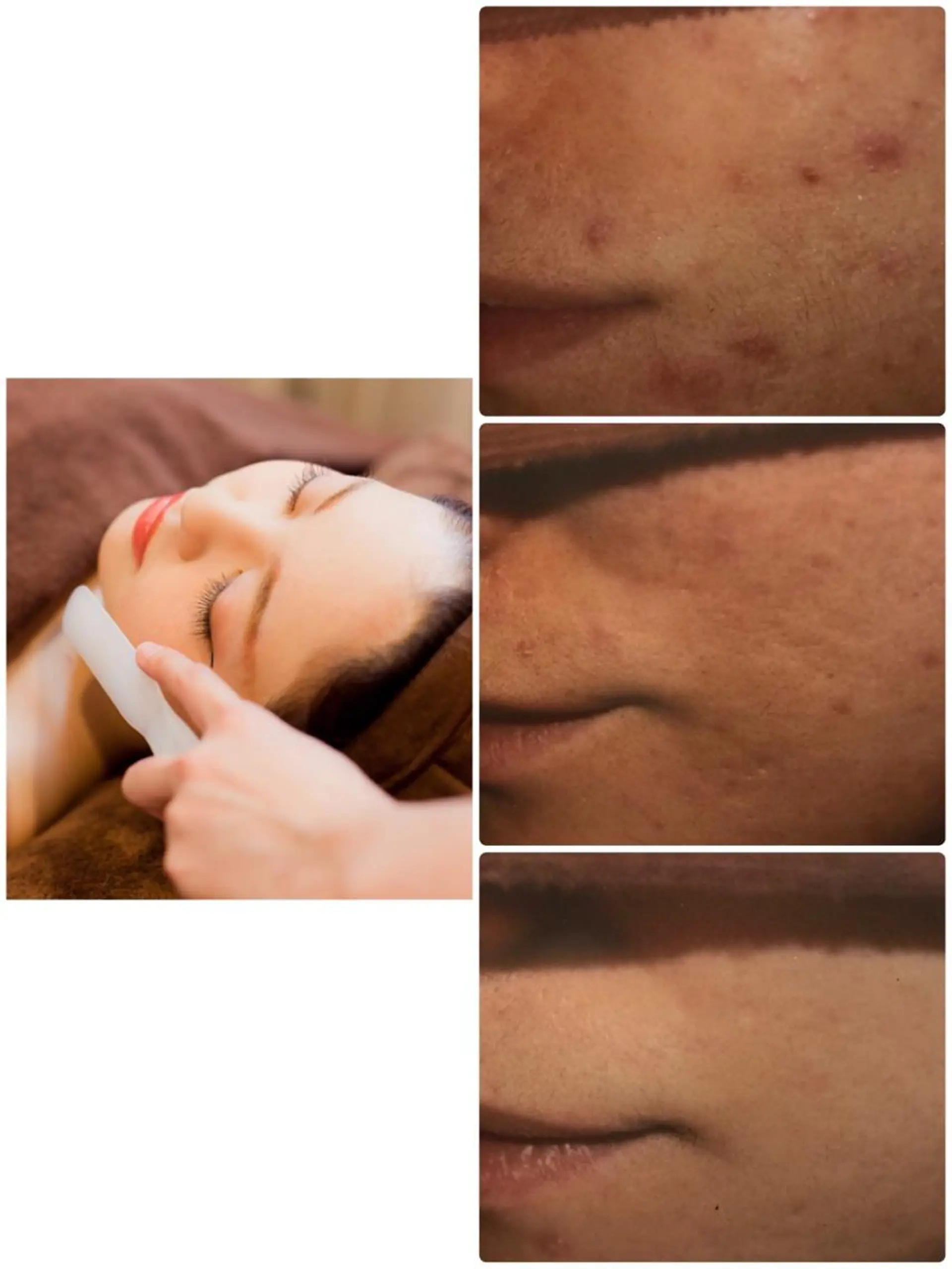 脱毛 美肌脱毛専門サロン Dione栄店のエステ・リラクイメージ