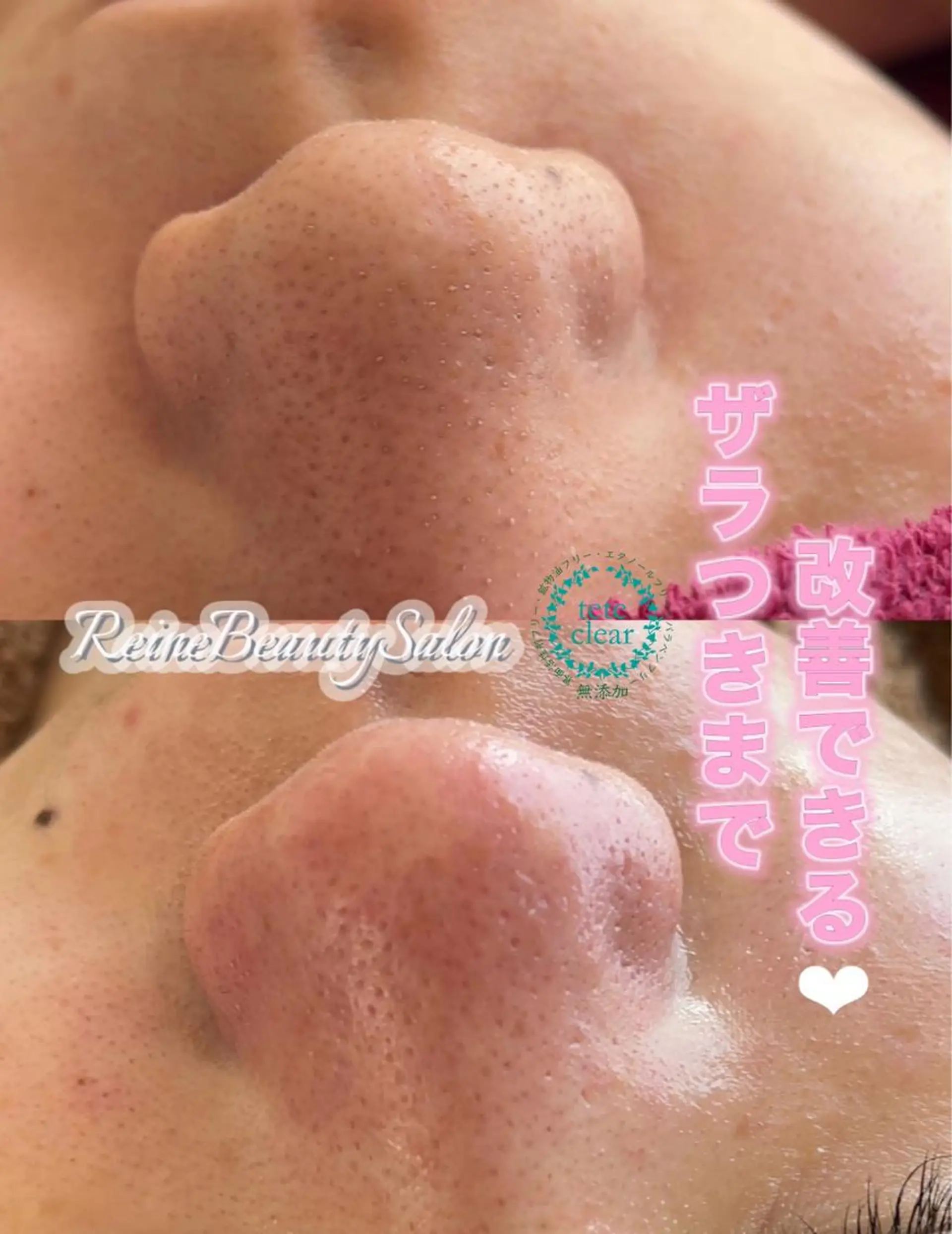 Reine BeautySalon所属・毛穴/シミ肝斑/脱毛 横山梨里のエステ・リラクイメージ