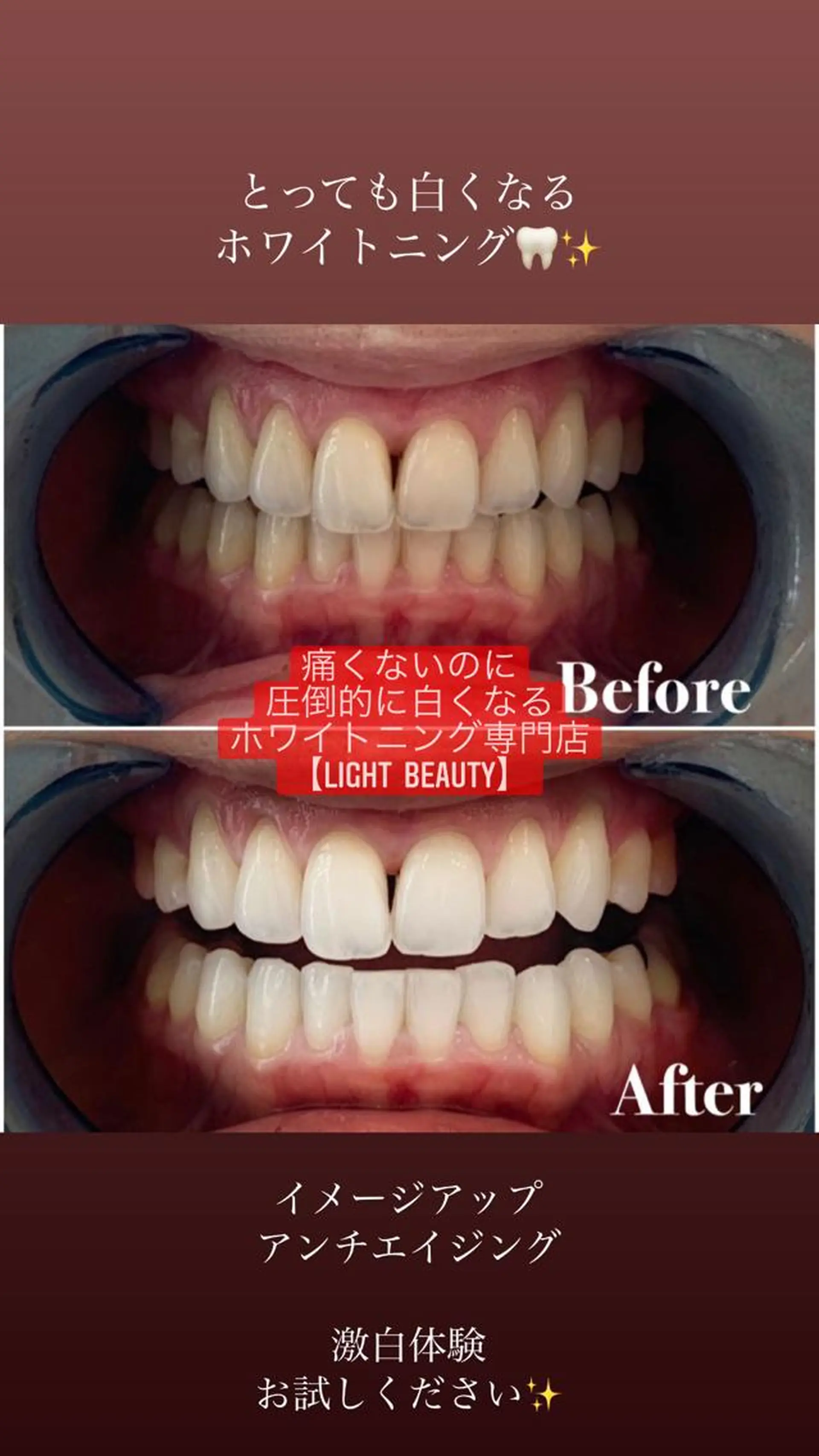 ライトビューティー 恵比寿店のその他イメージ