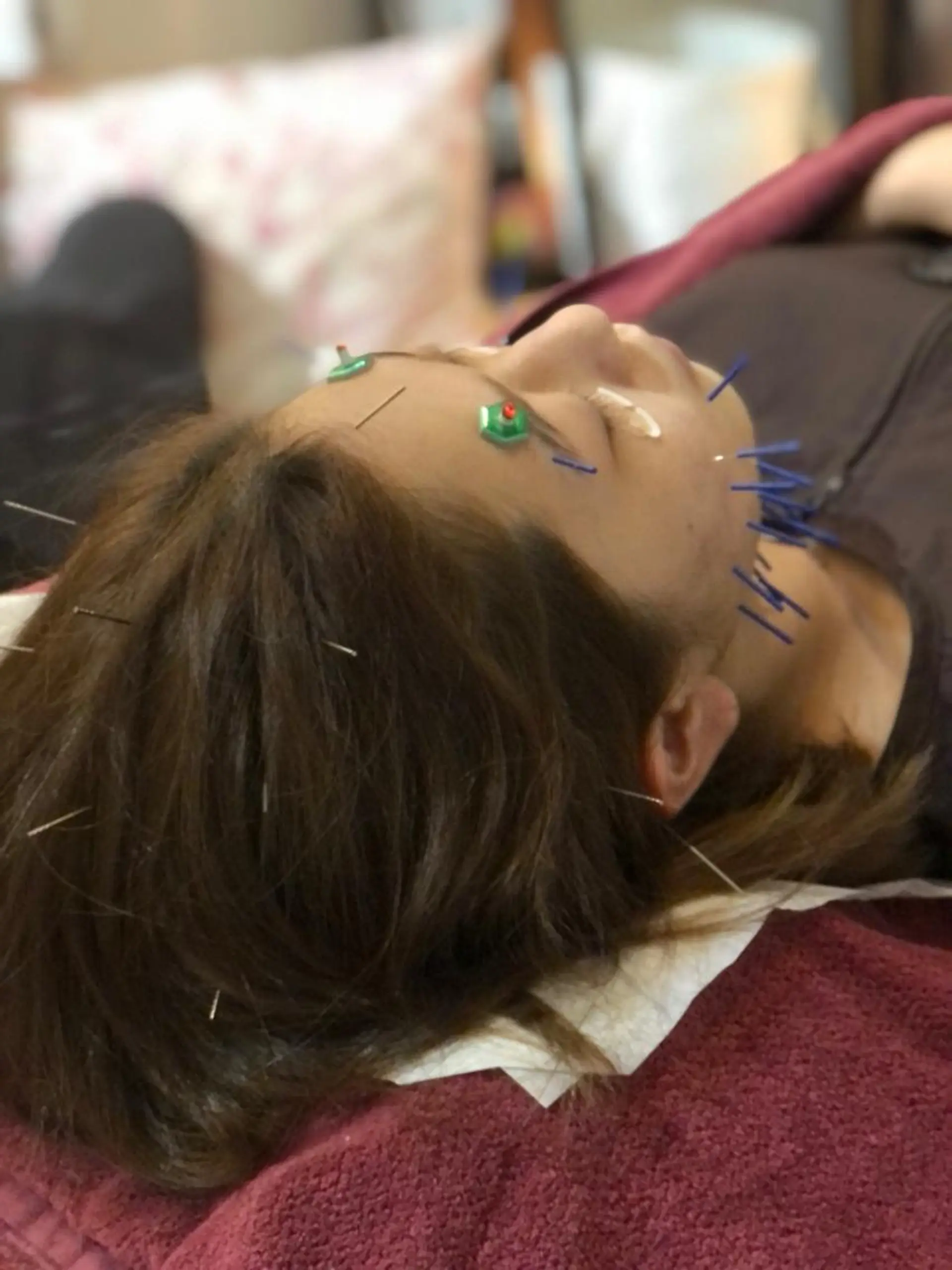 エステ リラク 美容鍼灸女性専用 りんご鍼灸治療院のエステ・リラクイメージ