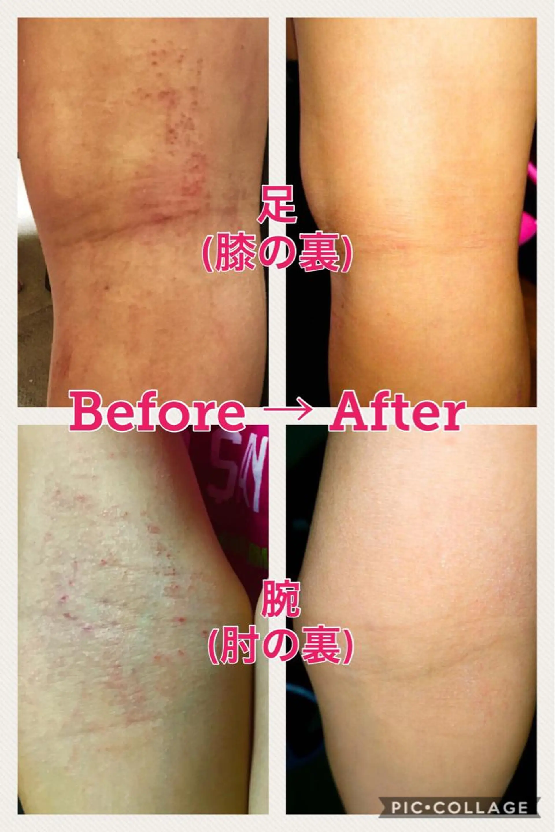 Bène Soin du Esthétique所属・逵中 元香のエステ・リラクイメージ