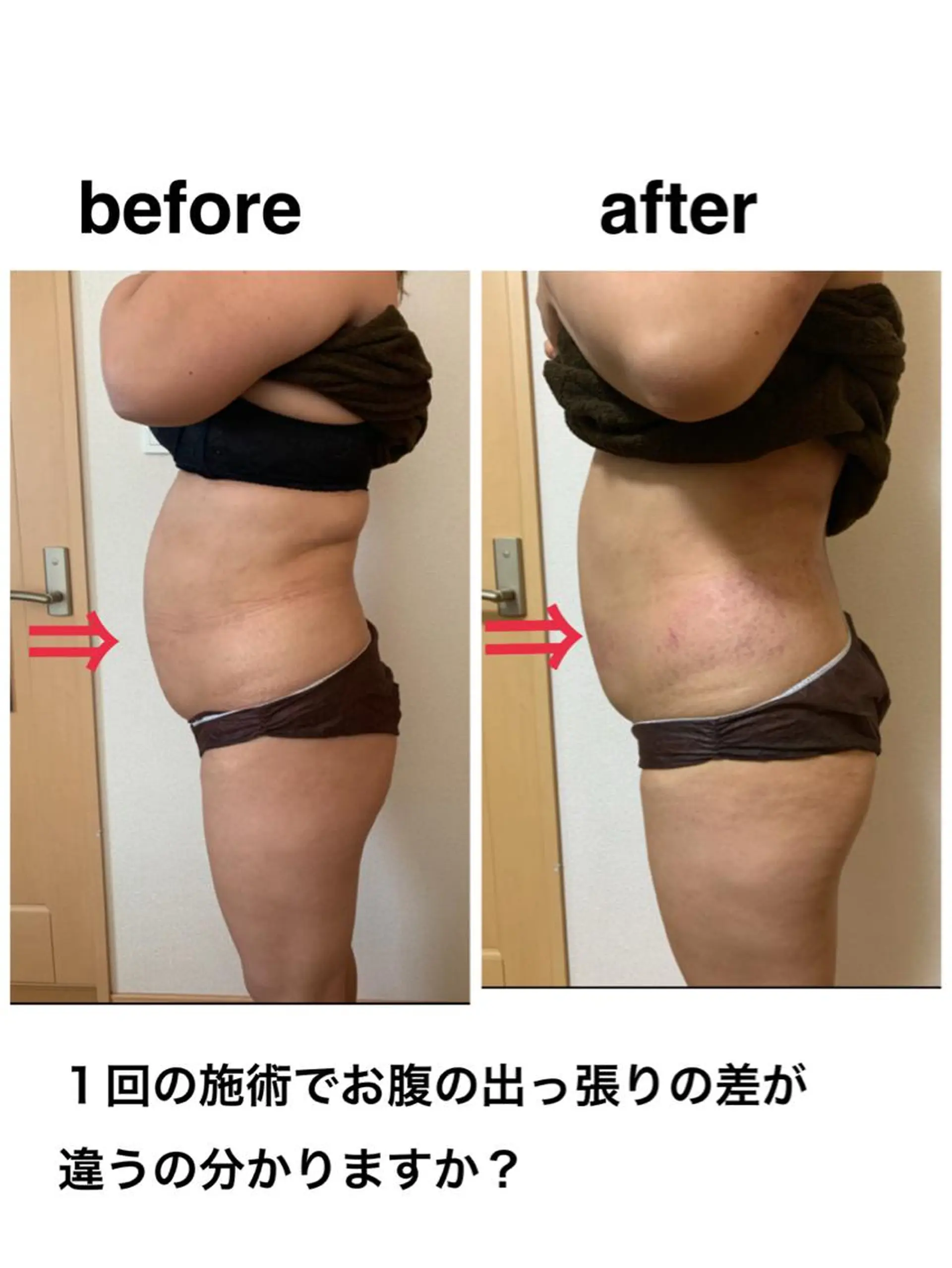 エステ リラク 痩身/脱毛/ネイル HARUKAのエステ・リラクイメージ