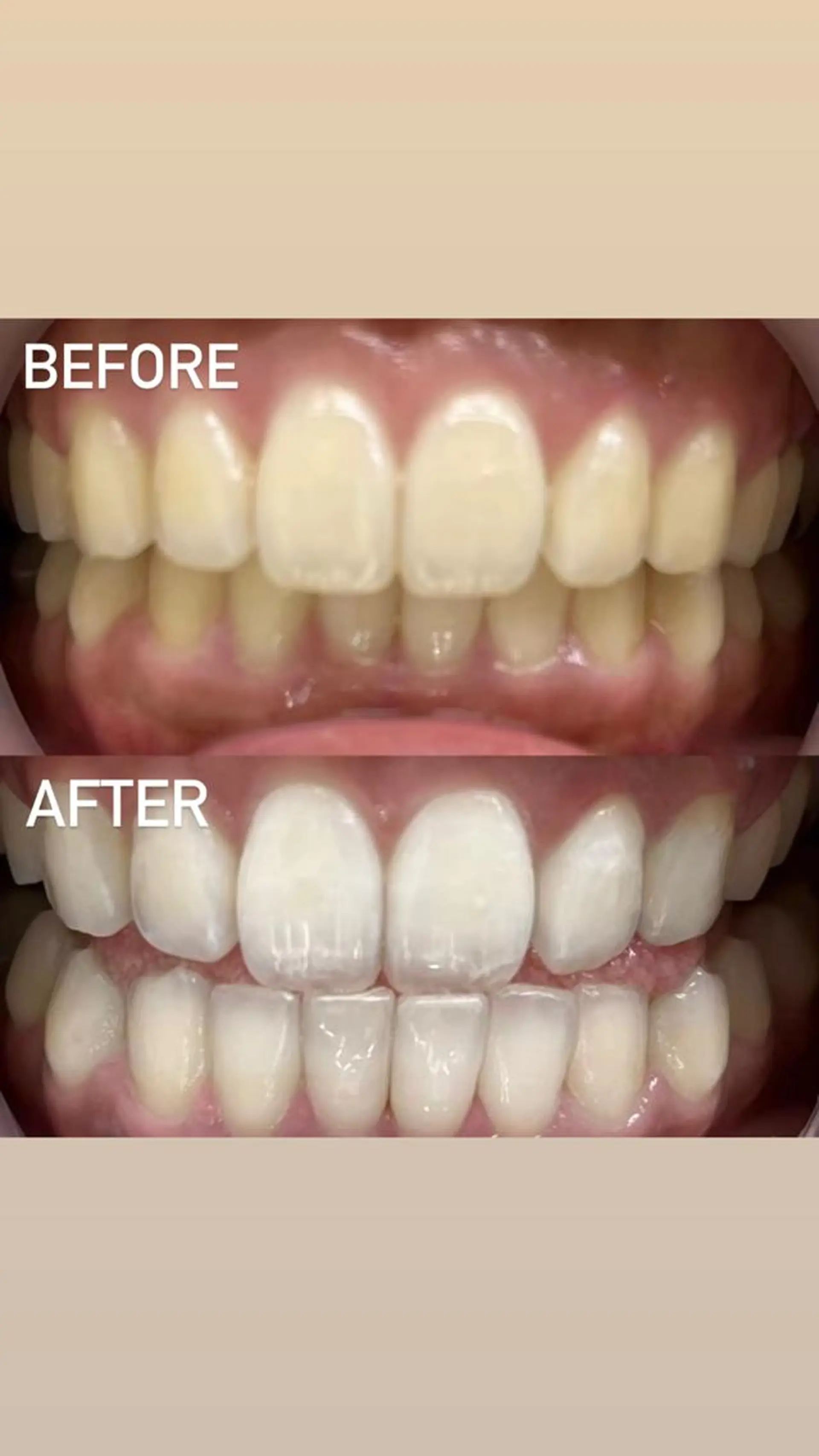 LBSホワイトニング 銀座店💎店長浦和のその他イメージ