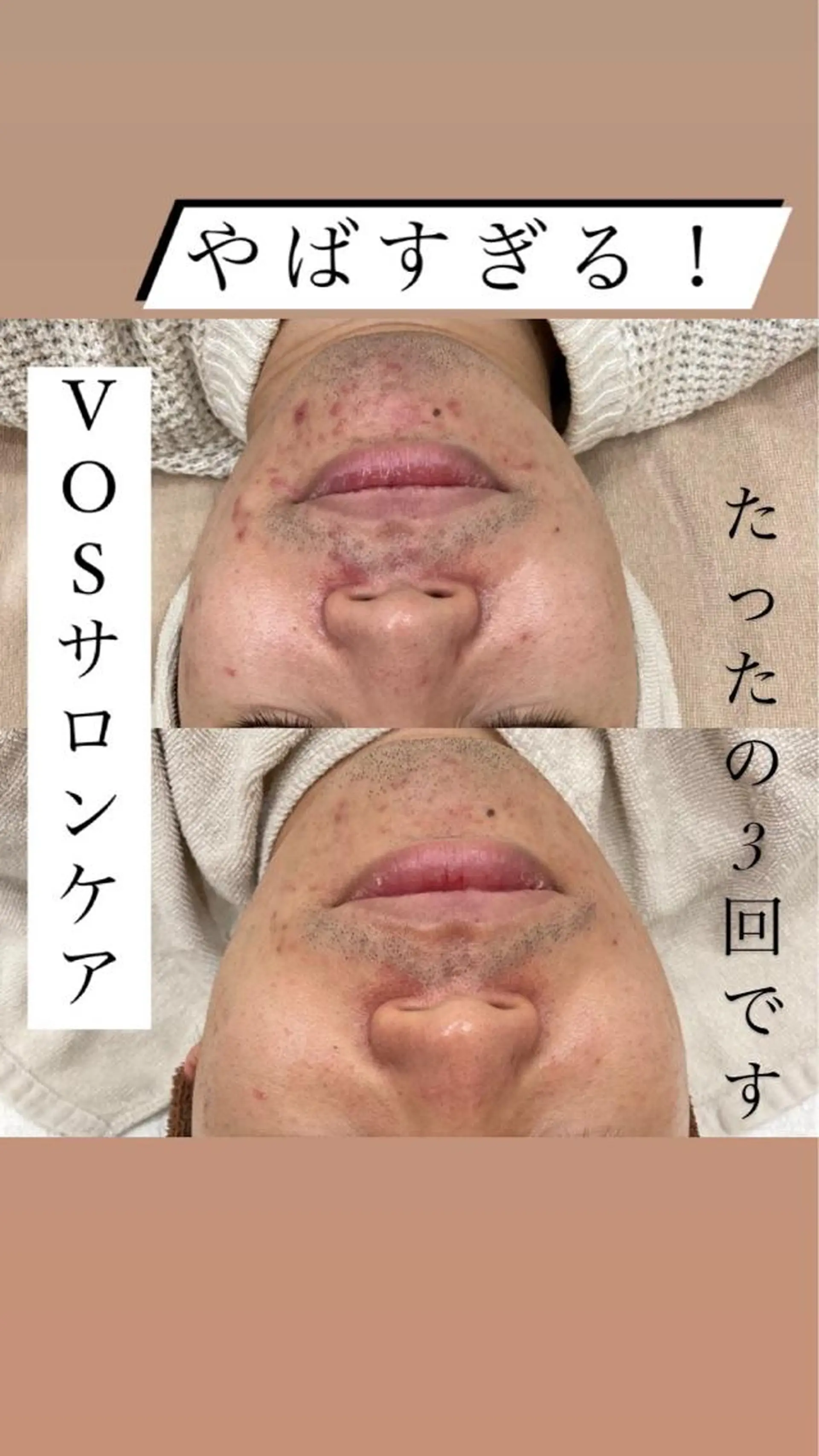 laluna saki...のその他イメージ