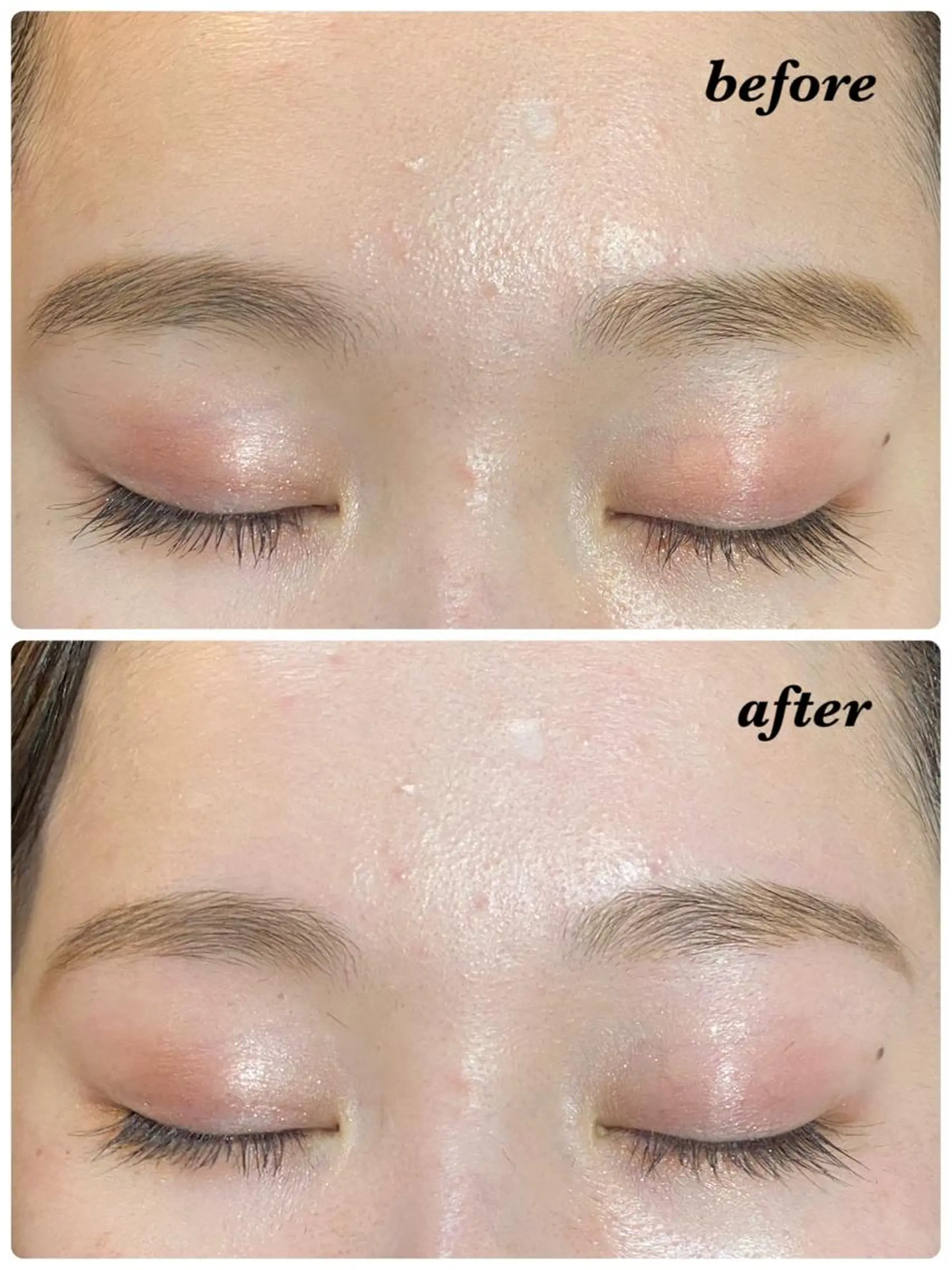 アイブロウ ハーブピーリング/韓国肌管理/フェイシャル/毛穴洗浄/眉毛/顔脱毛【糸脱毛専門】rev所属・ハーブピーリング🌹 毛穴洗浄❤️眉waxのエステ・リラクイメージ