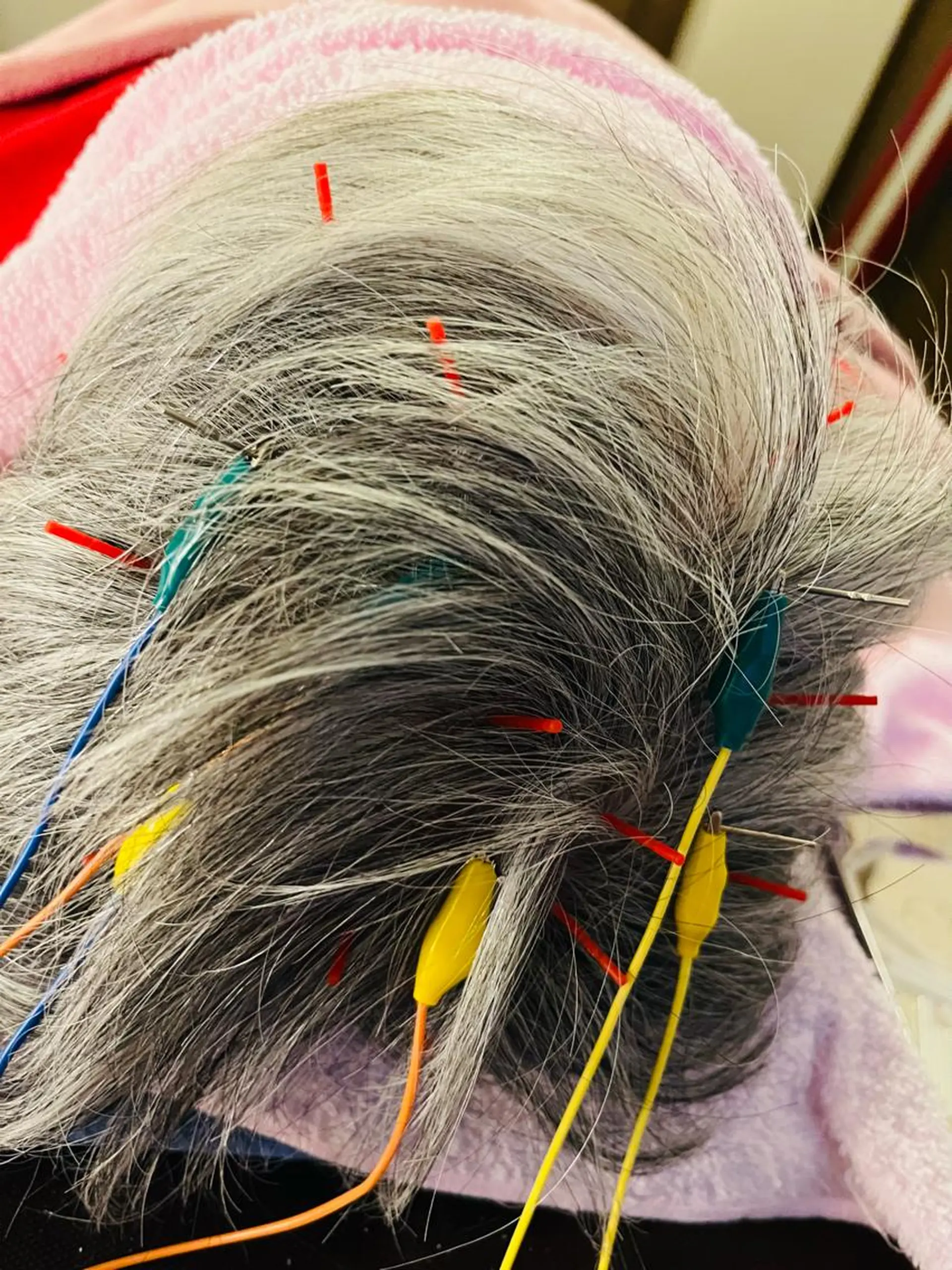 アロマ･美容鍼･カッ ピング「麗」鍼灸院のエステ・リラクイメージ