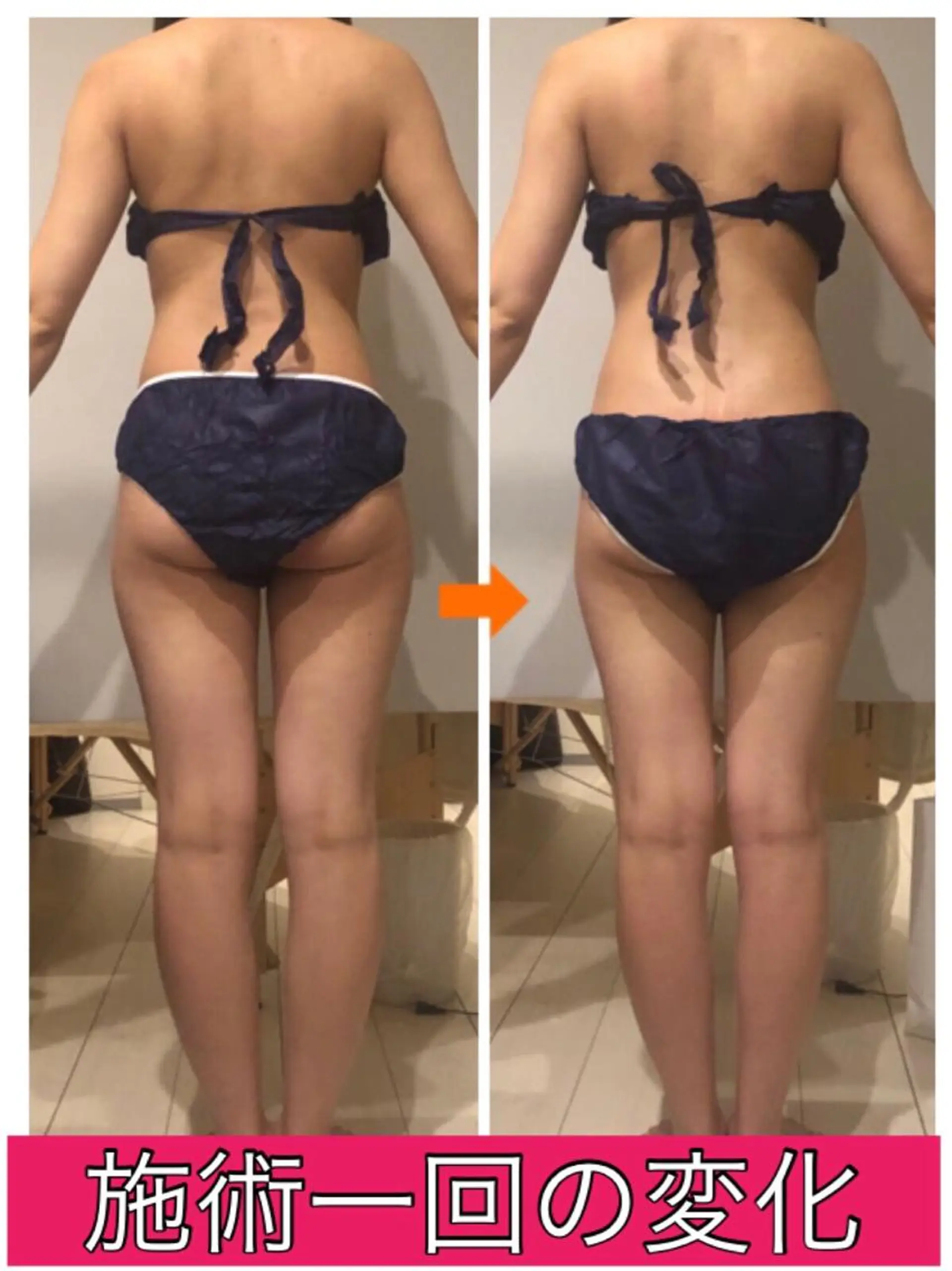 ロング カラー パーマ ヘアアレンジ メンズ キッズ ネイル マツエク・マツパ ‍痩身＆ボディ 結果出し🌟丹野のエステ・リラクイメージ