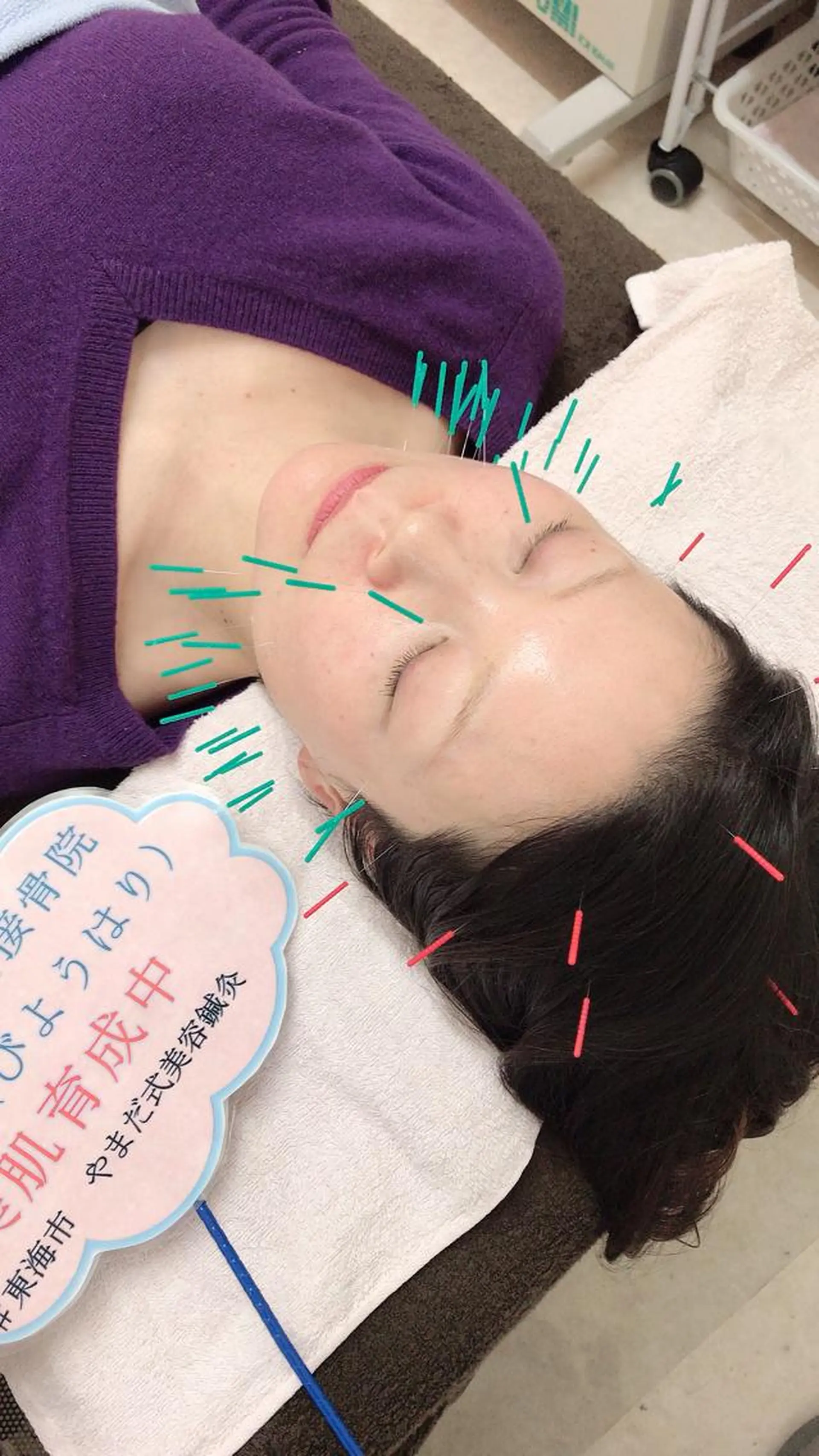 その他 やまだ鍼灸接骨院（やまだしんきゅうせっこついん）所属・山田 晃のエステ・リラクイメージ