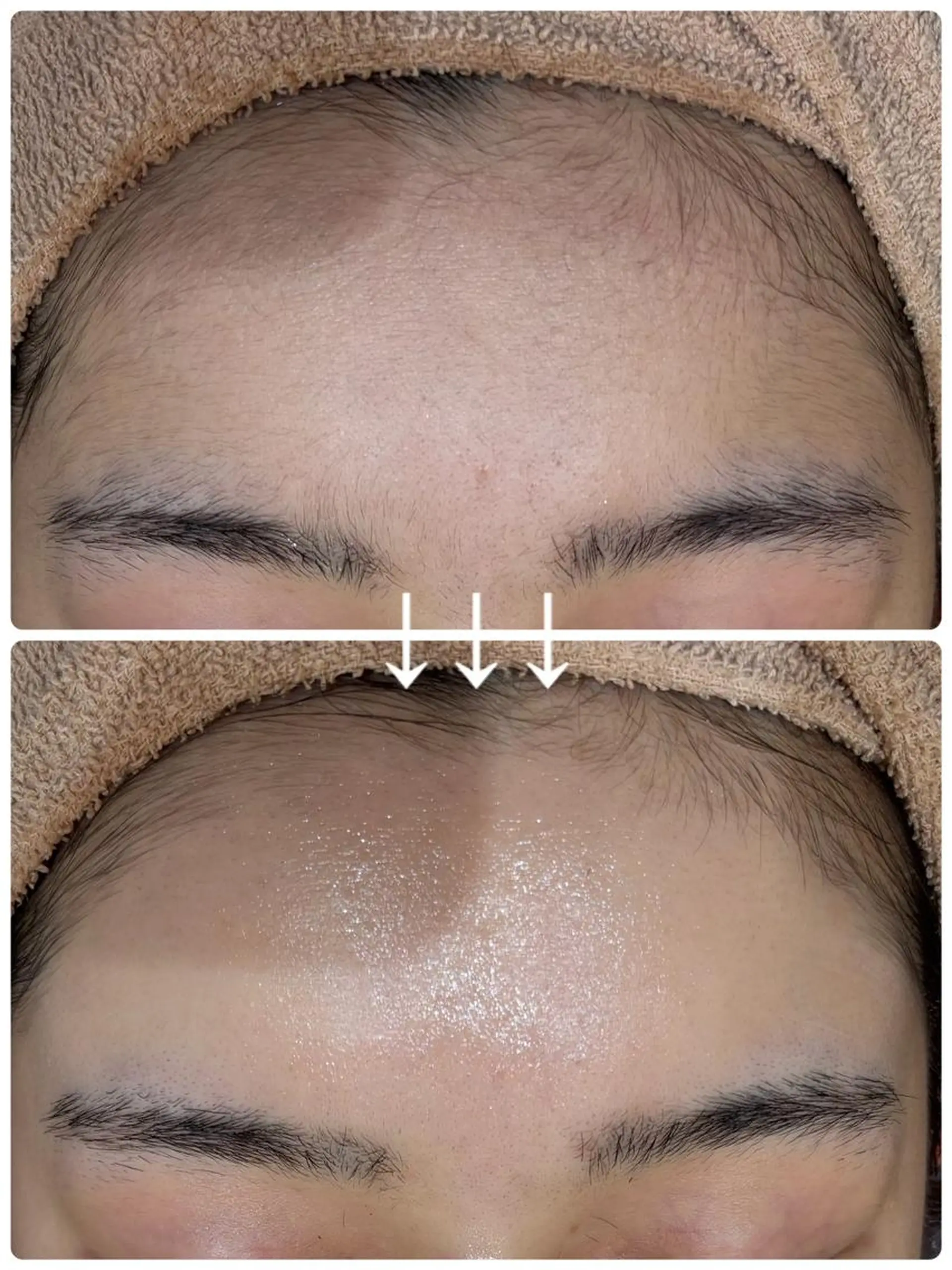 脱毛 👑Linolaby RAYVIS👑🌼のエステ・リラクイメージ