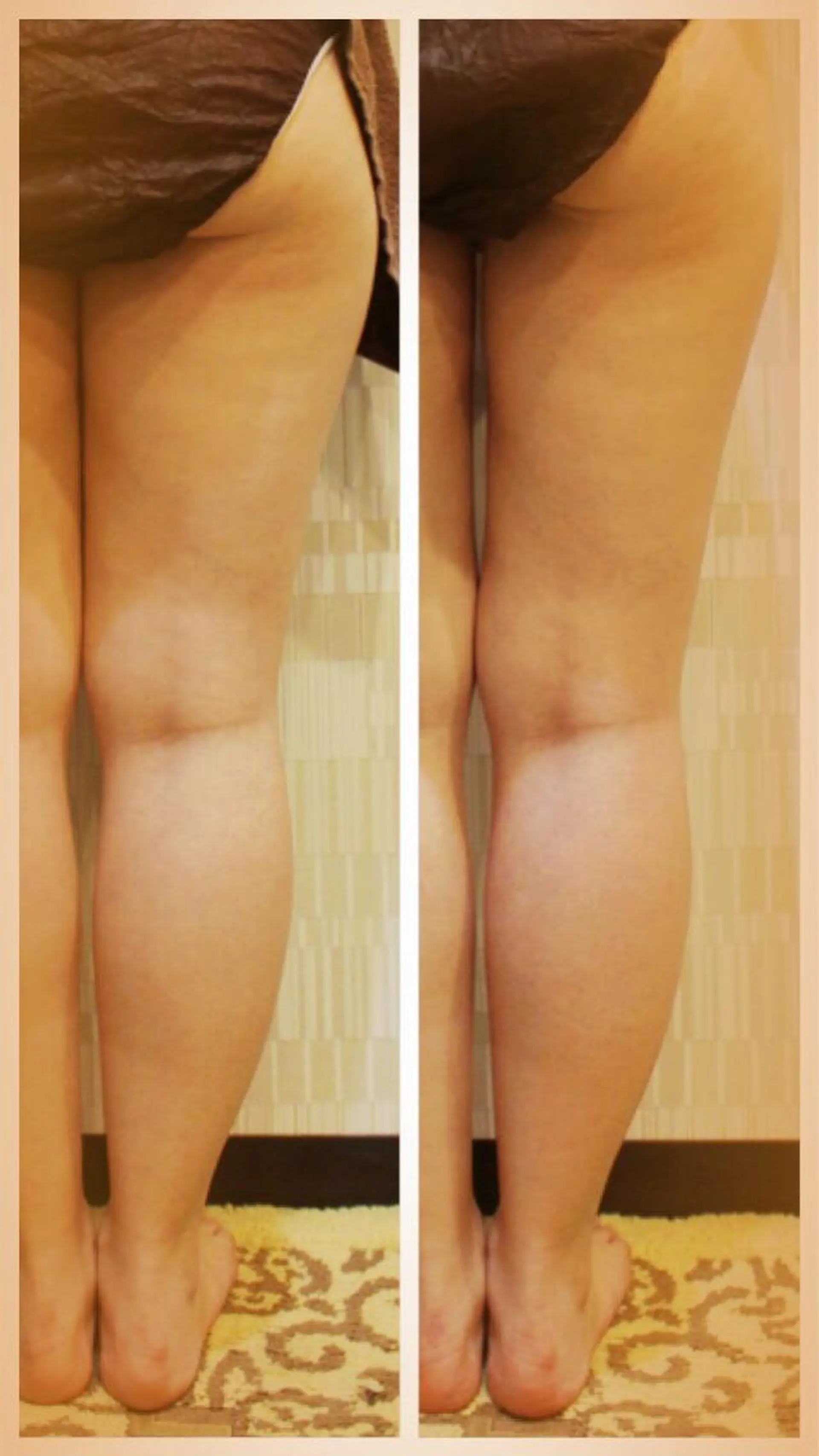 ANRIRE (アンリール)のエステ・リラクイメージ