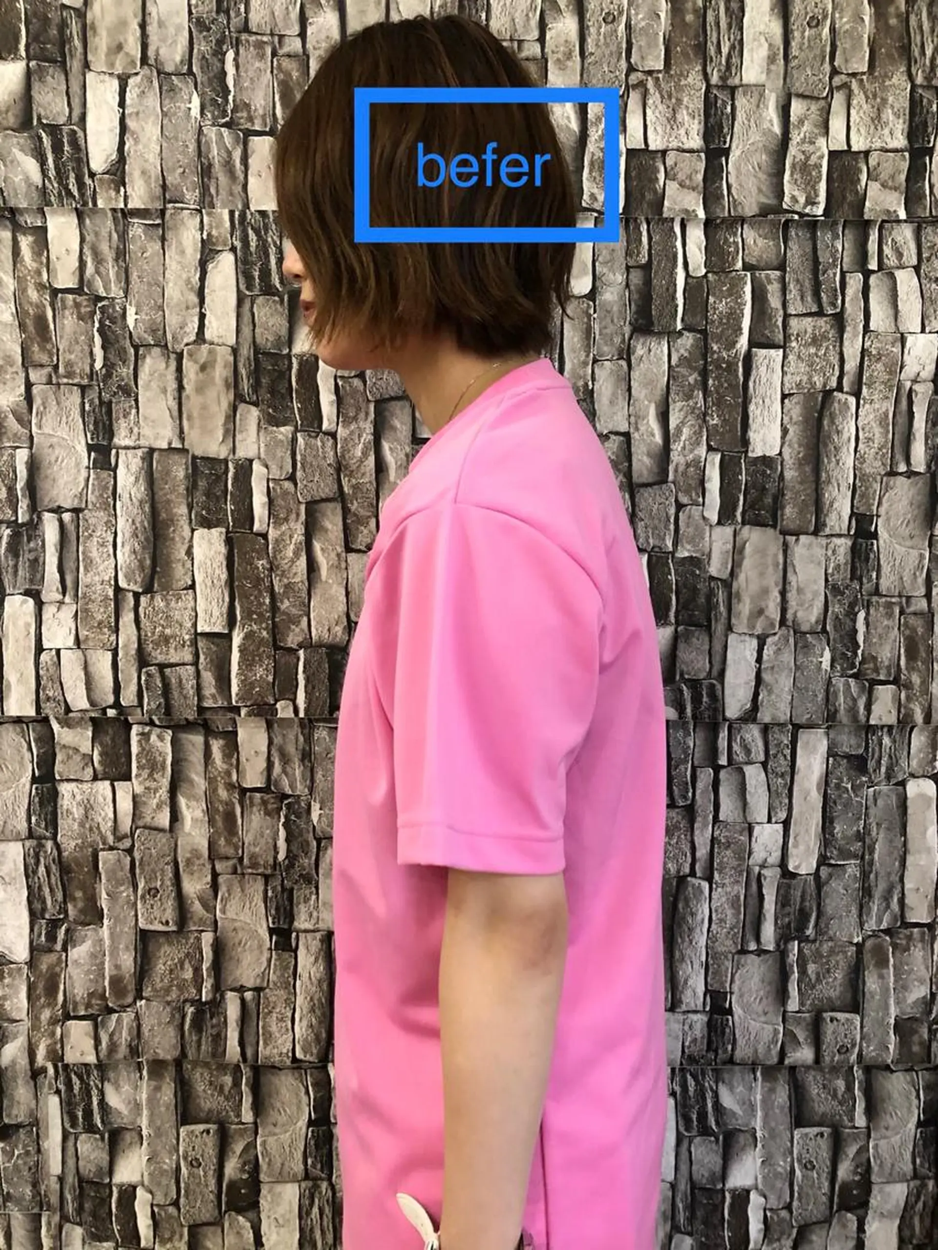 特別クーポン配布中 美容鍼・整体お得に！のその他イメージ