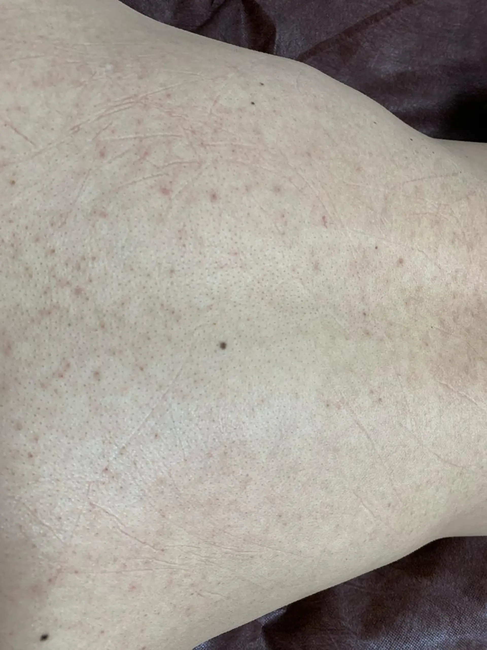 メンズ キッズ 脱毛 脱毛SALON RaYNiCKのエステ・リラクイメージ