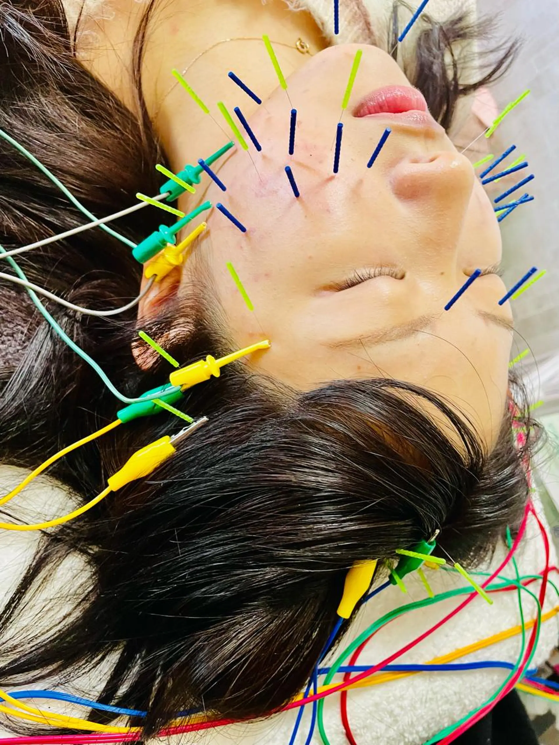 美容鍼灸サロン mahoroba院長のエステ・リラクイメージ