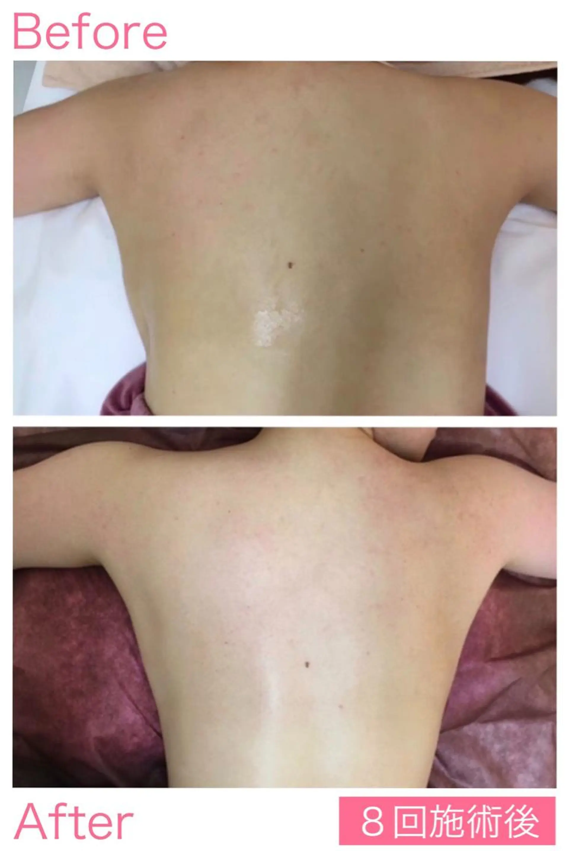 エステ リラク Lov. it ﾗｳﾞｨｯﾄのエステ・リラクイメージ